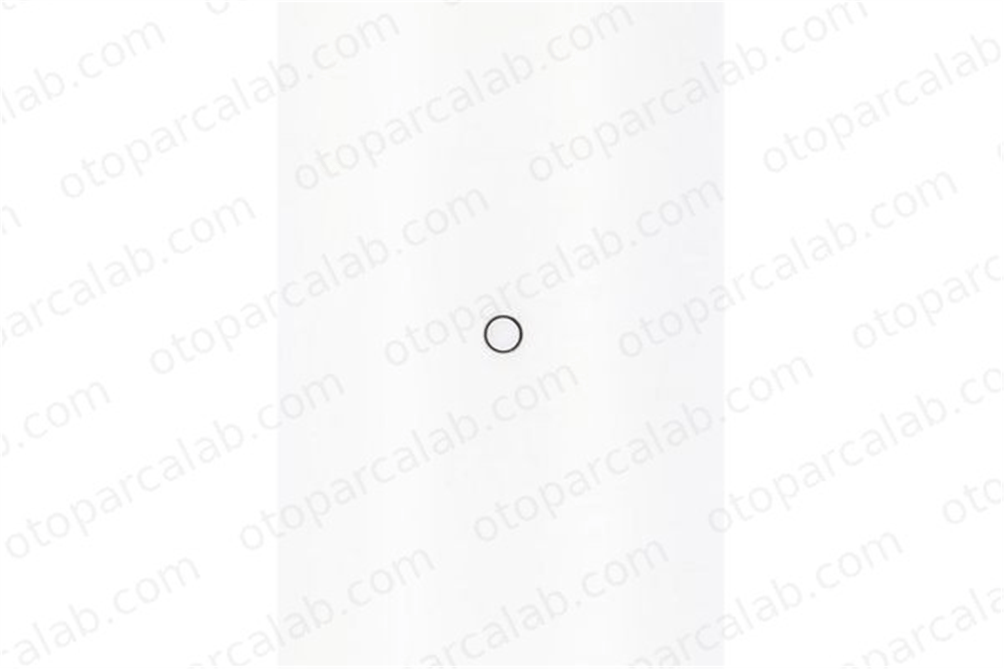 CORTECO 49138519 Üst Kapak Contası (Külbütör) CITROËN BERLINGO Kasa/büyük limuzin C3 AIRCROSS II 49138519 9817380880