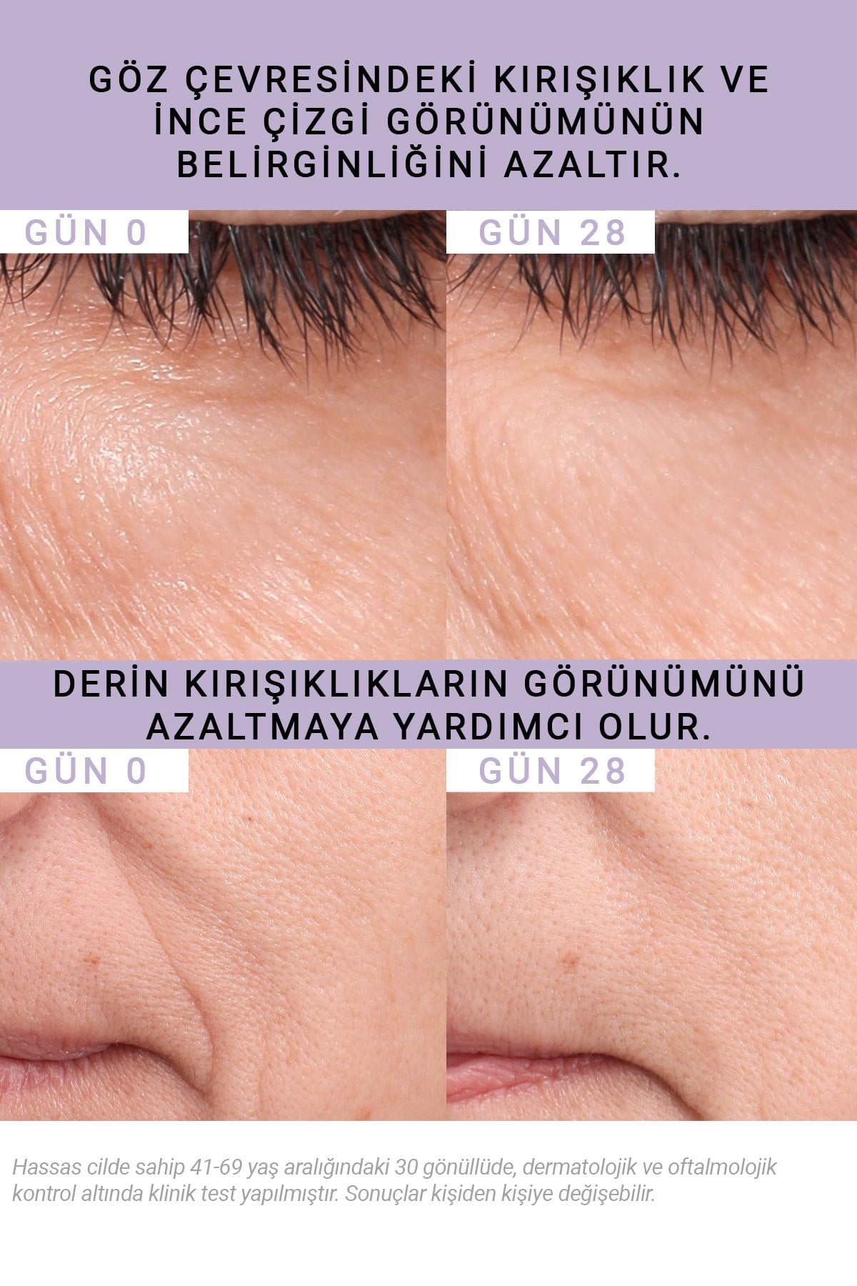 Bakuchiol %0,5 Kırışıklık Karşıtı Serum 15ML | Hassas Ciltler için Retinol Alternatifi
