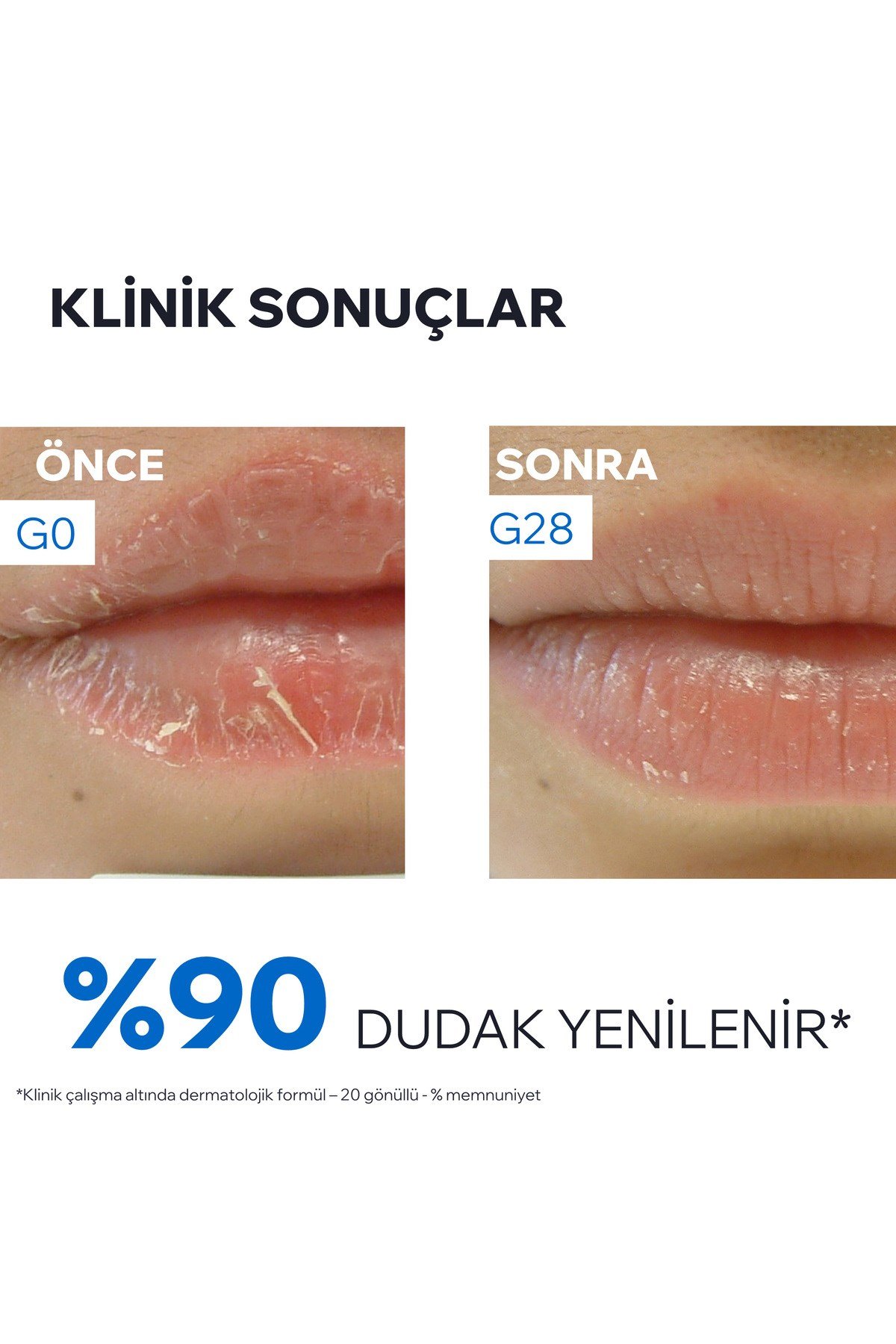 BARIEDERM Onarıcı ve Yatıştırıcı Dudak Bakım Kremi 15 ml