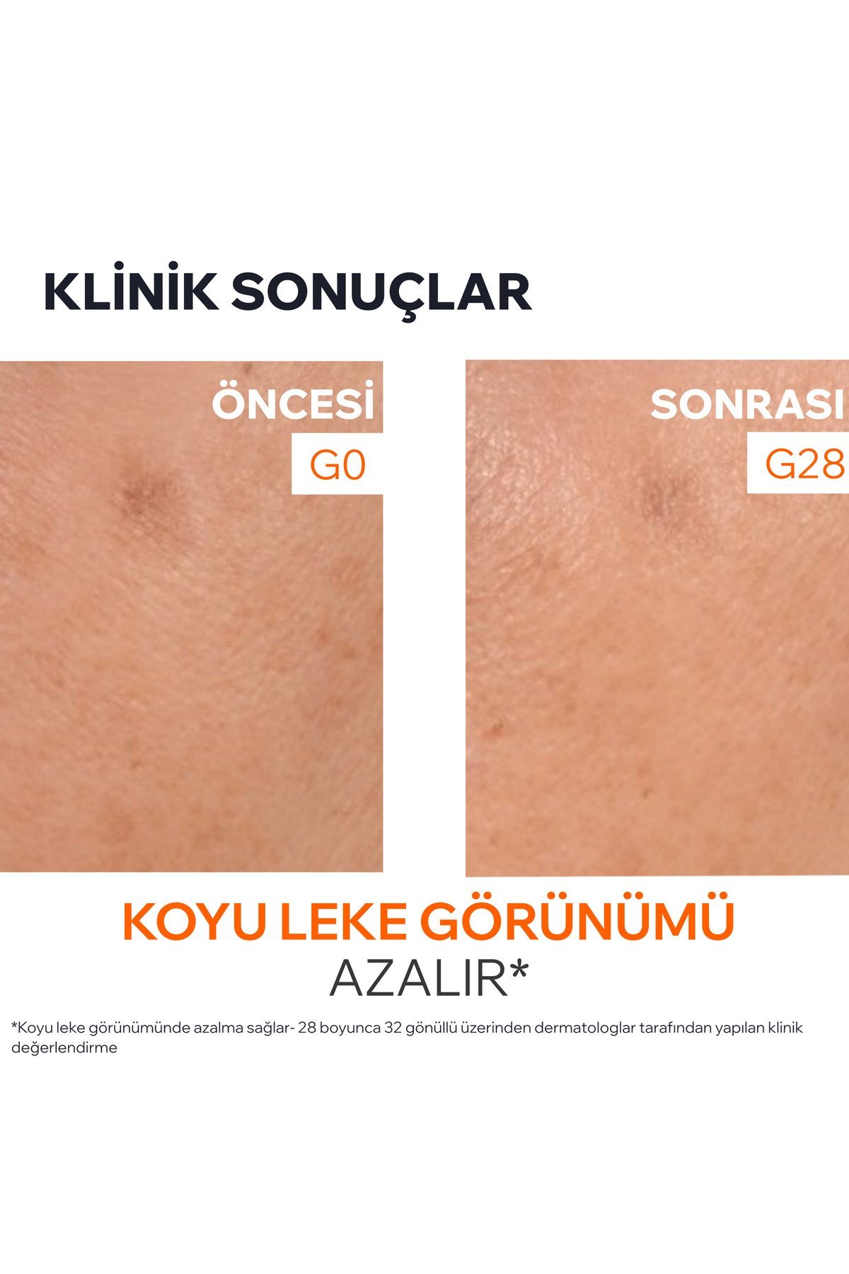 DEPIDERM Leke Karşıtı Aydınlatıcı Serum 30 ml