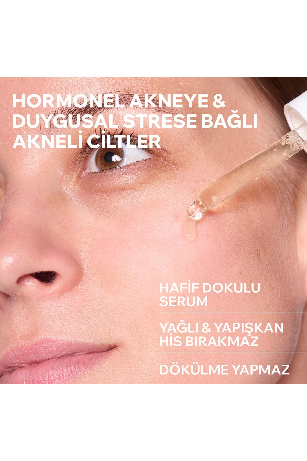 HYSEAC Akneye Eğilimli Karma ve Yağlı Ciltler için Leke Karşıtı Serum 30 ml