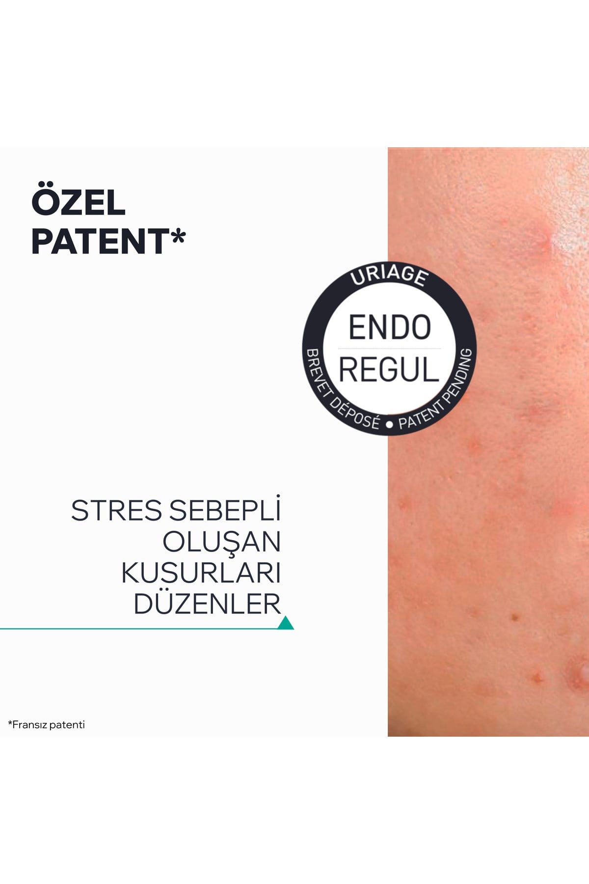 HYSEAC Akneye Eğilimli Karma ve Yağlı Ciltler için Leke Karşıtı Serum 30 ml
