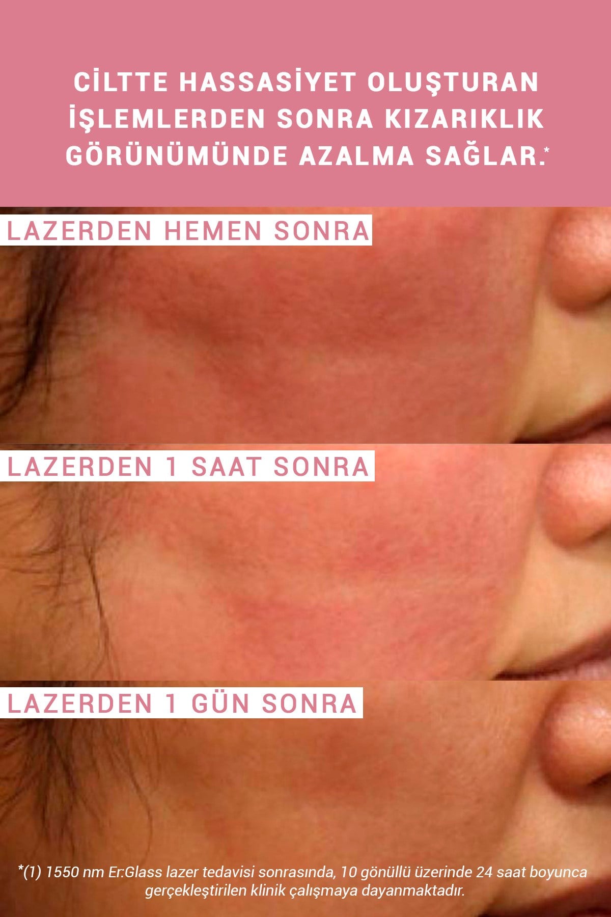Pure Active Enoxolone Hassas ve Rozalı Ciltler İçin Kızarıklık Karşıtı Konsantre Bakım Serumu 15ML