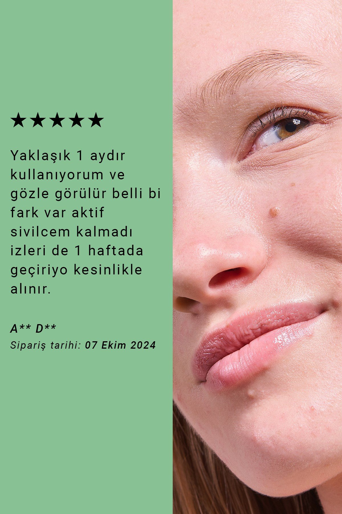 Pure Active Propolis Akne Karşıtı Antienflamatuar & Yatıştırıcı Etkili Konsantre Bakım Serumu 15ML