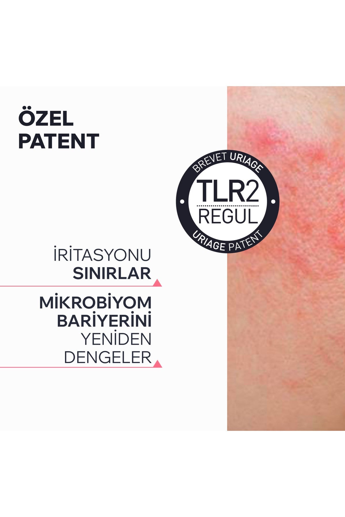Roseliane Kızarıklık Karşıtı Nemlendirici Serum 30 ml