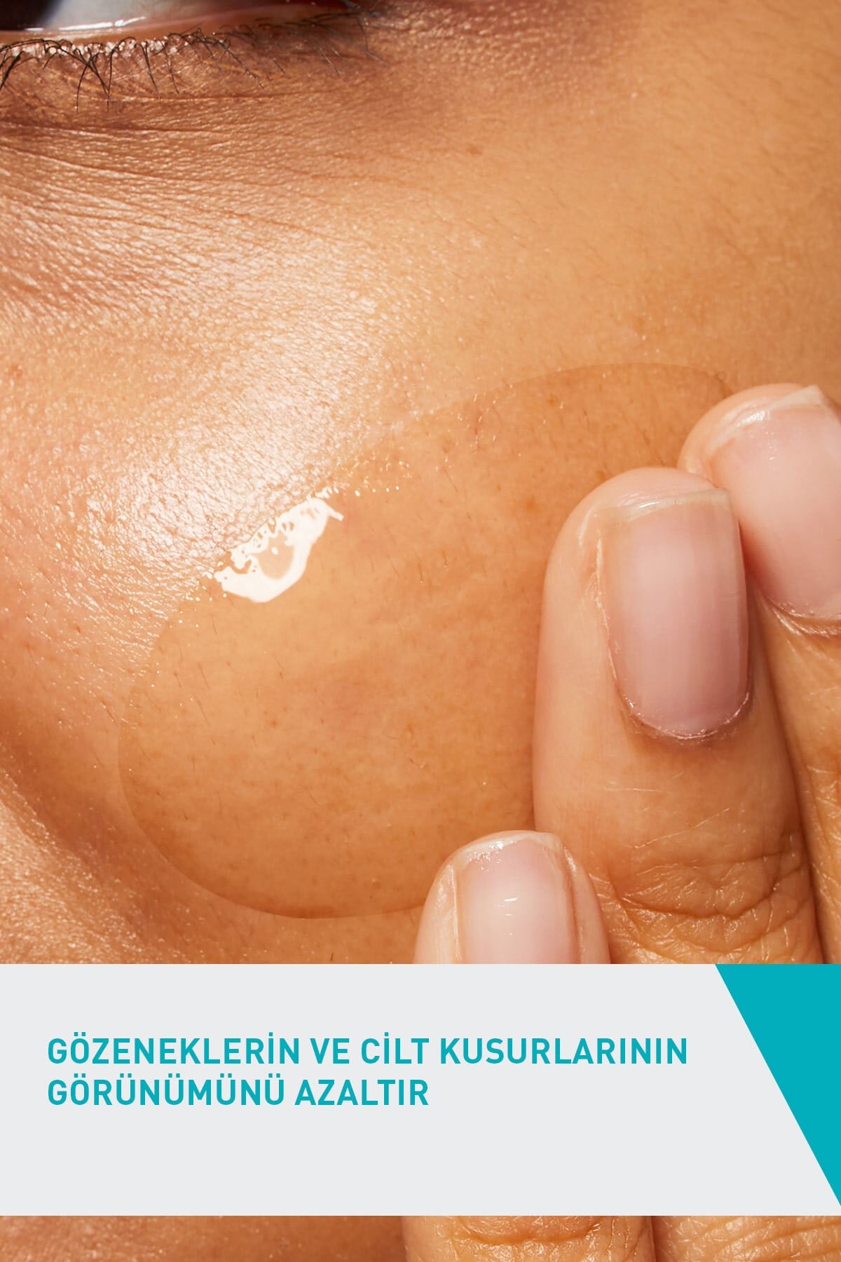 Salisilik Asit & Glikolik Asit İçerikli Yağlı ve Akneye Eğilim Gösteren Ciltlere Özel Yüz Kremi 40ML
