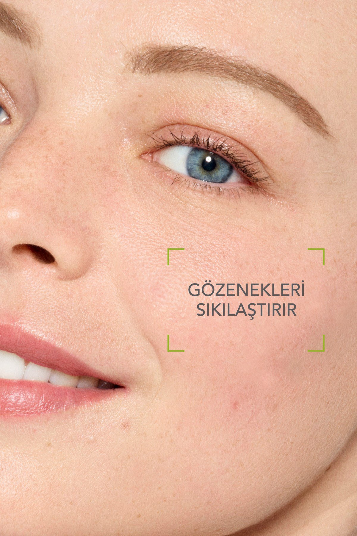 Sebium Lotion Salisilik Asit İçeren Gözenek Sıkılaştırıcı Siyah Nokta Karşıtı Tonik 200 ml