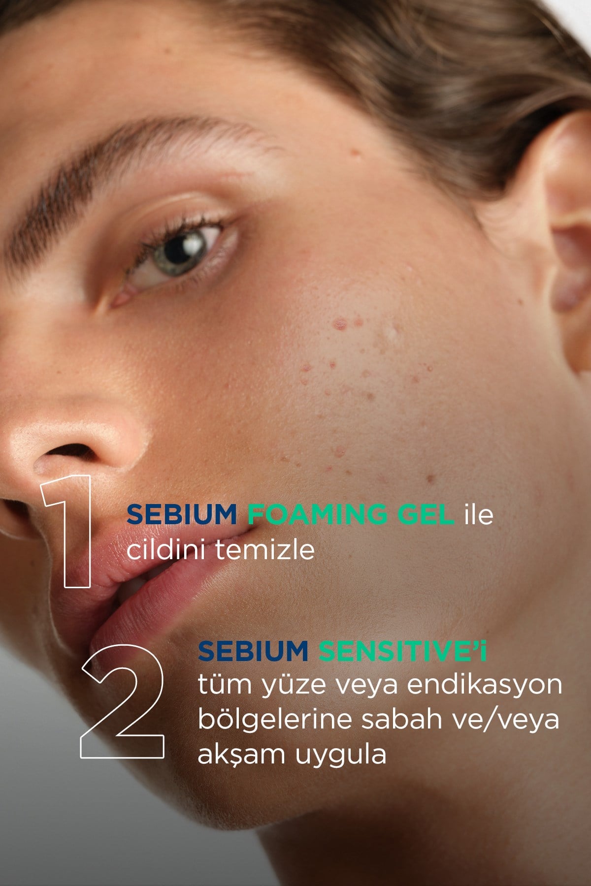 Sebium Sensitive Hassas ve Akne Eğilimli Ciltler, Kızarıklık Karşıtı Nemlendirici Bakım Kremi 30 ml