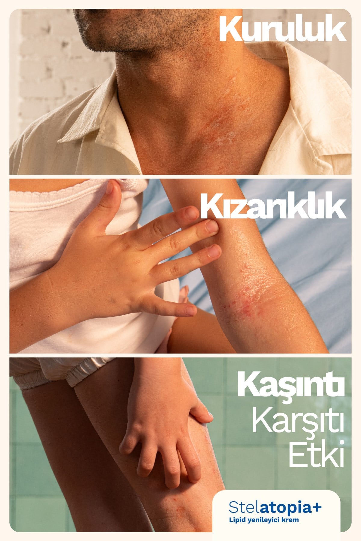 Stelatopia+ Lipit Yenileyici Krem 150 ml