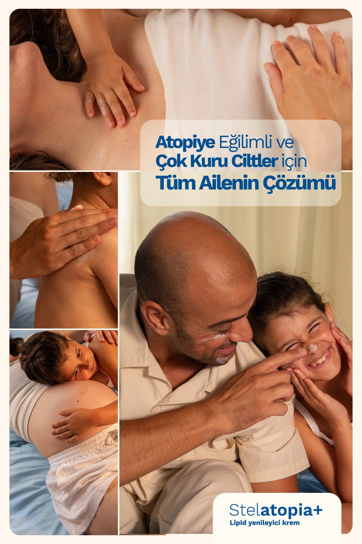 Stelatopia+ Lipit Yenileyici Krem 150 ml