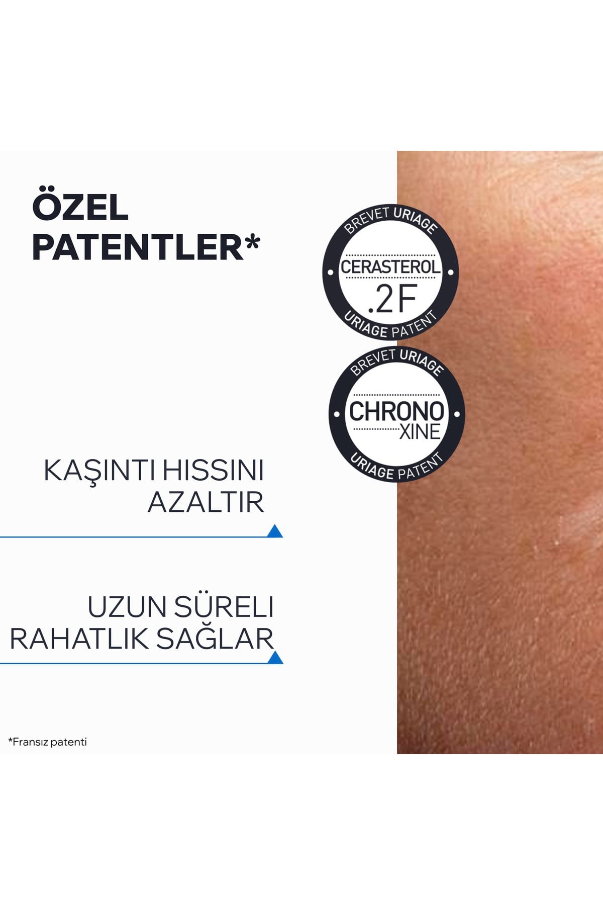 XEMOSE C8+ Atopiye Eğilimli ve Çok Kuru Ciltler İçin Karşıtı Yatıştırıcı Balm 200 ml