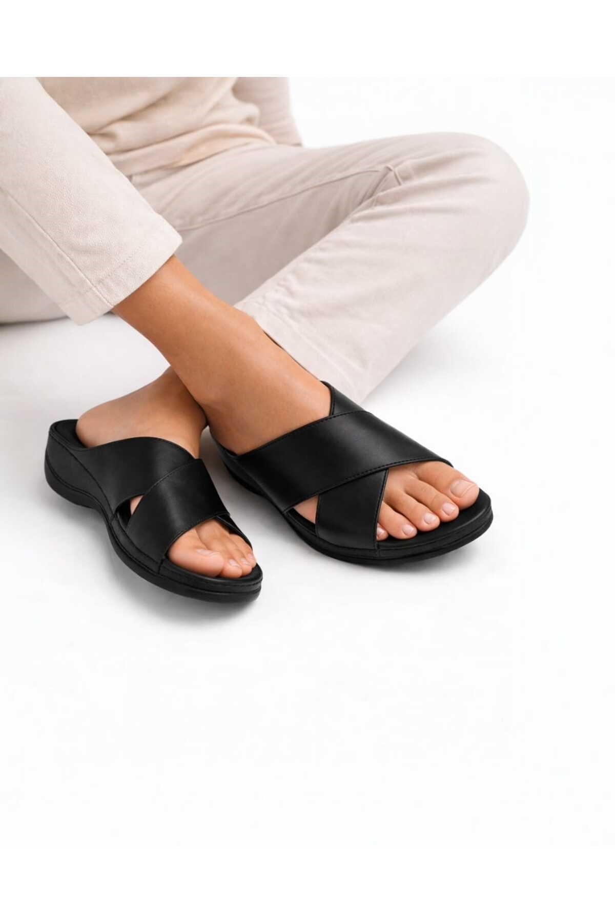 Kadın Siyah Jelly Cool Halluks Valgus Ortopedik Terlik - Anneler Günü Hediyesi