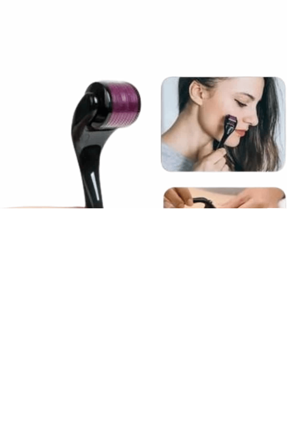 Titanyum Uçlu Derma Roller 540 İğneli 1 mm Gözenek Azaltıcı Akne İzlerine Uygun