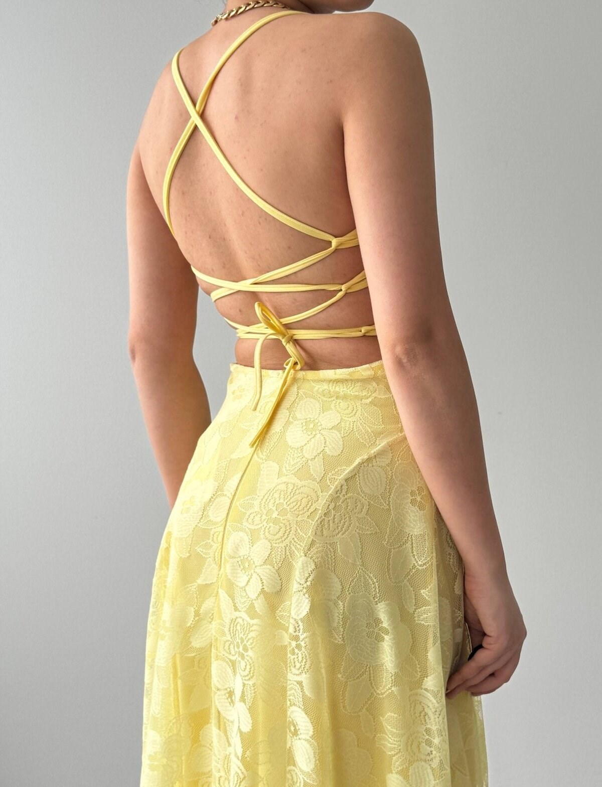 Husa Back-Tie Dress