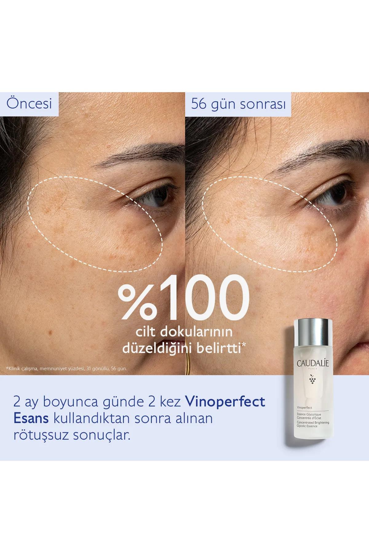 CaudalieCaudalie Vinoperfect Esans 100 mlCaudalie Vinoperfect Esans 100ml | Işıltılı Cilt Tonu