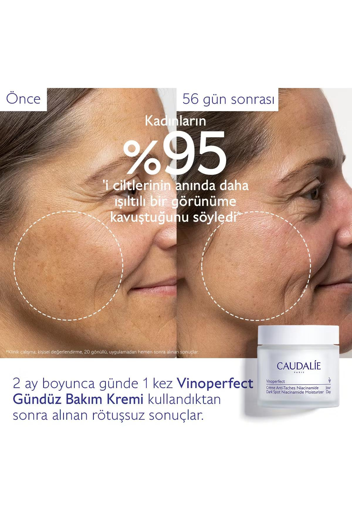 CaudalieCaudalie Vinoperfect Niasinamid Bakım Kremi 50 mlCaudalie Vinoperfect Niasinamid Krem 50ml | Leke Karşıtı Etki