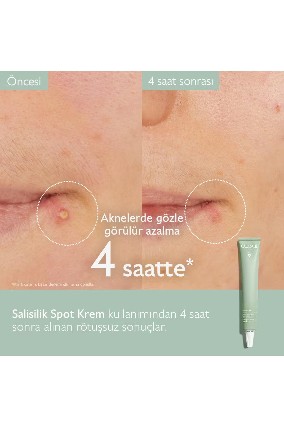 CaudalieCaudalie Vinopure Akne Karşıtı Salisilik Spot Krem 15 mlCaudalie Vinopure Akne Karşıtı Salisilik Spot Krem 15 ml | Hızlı Kargo & Orijinal Ürün
