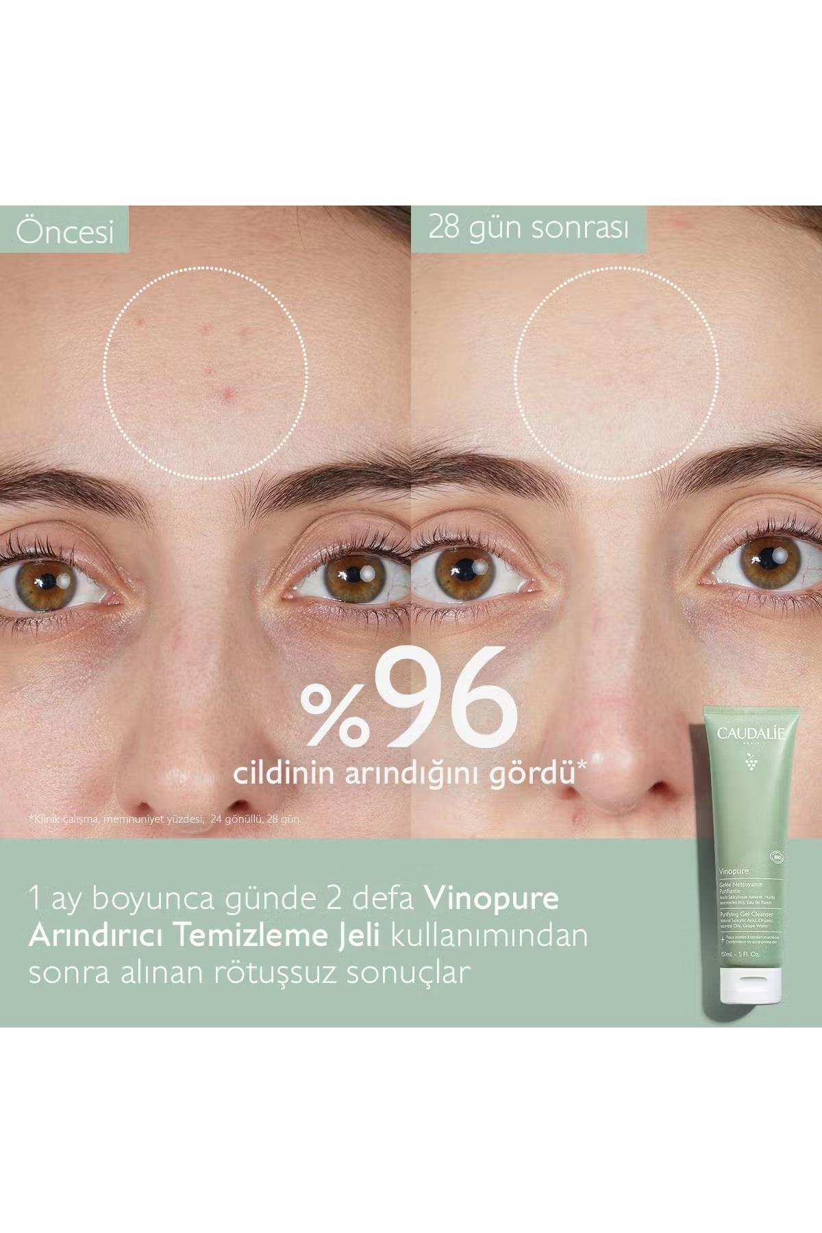 CaudalieCaudalie Vinopure Arındırıcı Temizleme Jeli 150 mlCaudalie Vinopure Purifying Gel Cleanser 150 ml Fiyatı ve Özellikleri | Mutlufiyatlar