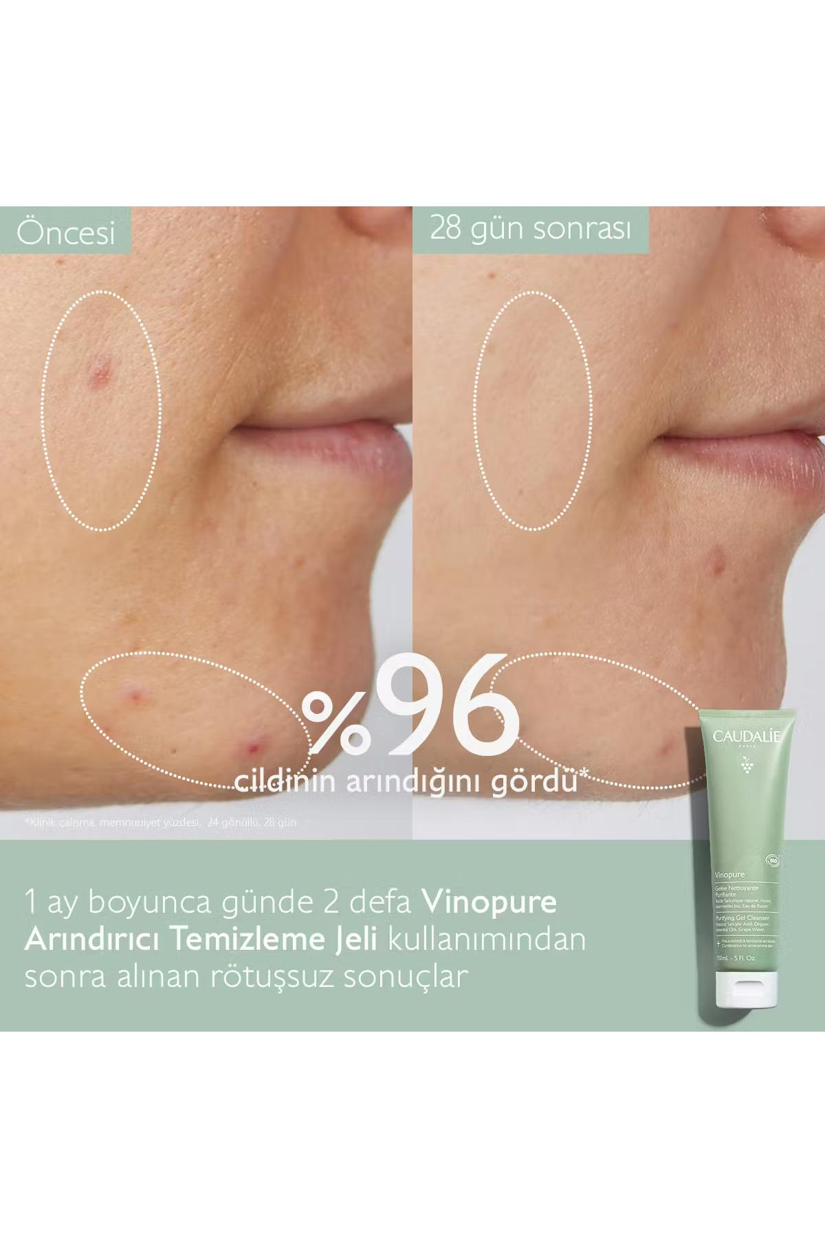 CaudalieCaudalie Vinopure Arındırıcı Temizleme Jeli 150 mlCaudalie Vinopure Purifying Gel Cleanser 150 ml Fiyatı ve Özellikleri | Mutlufiyatlar