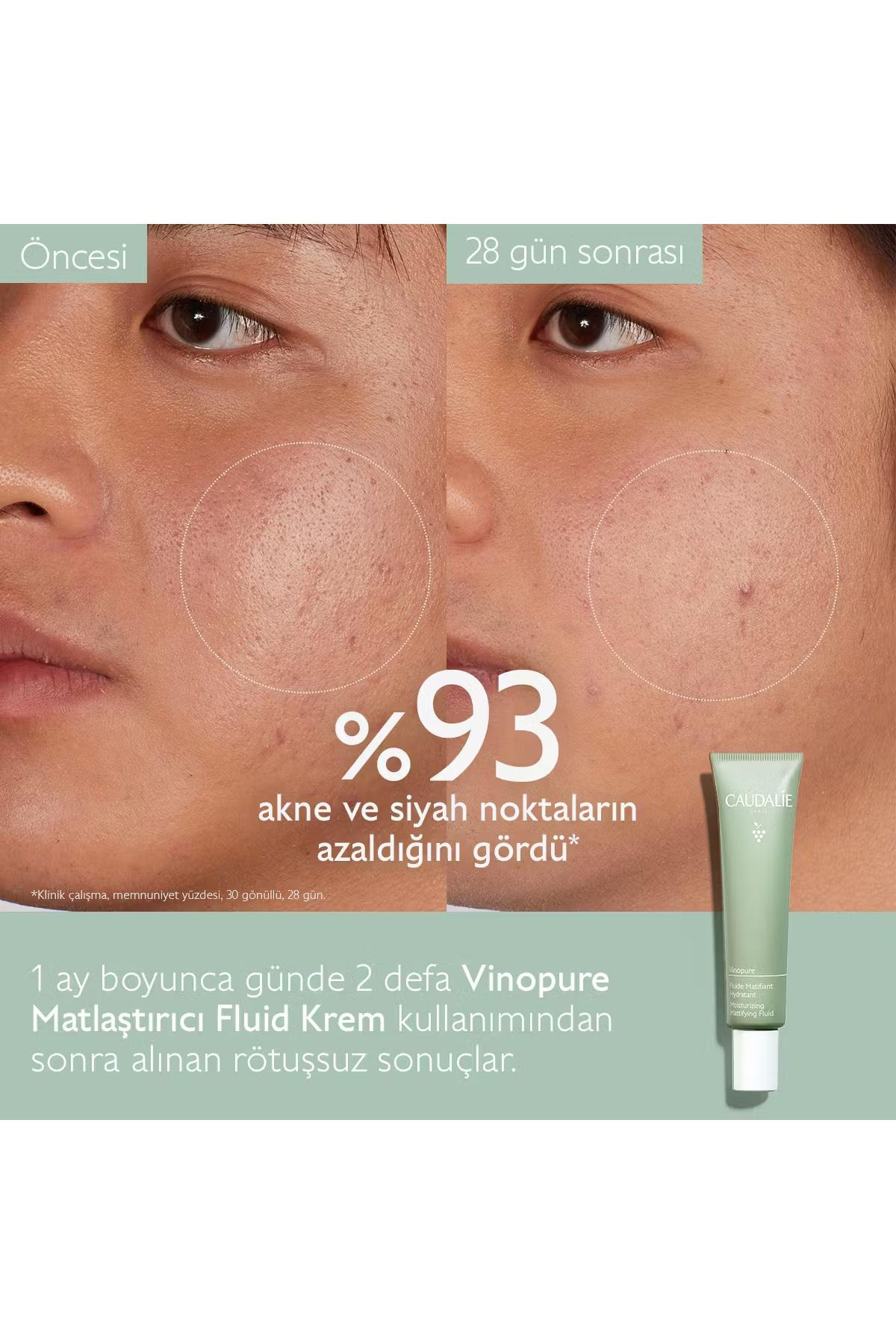 CaudalieCaudalie Vinopure Matlaştırıcı Fluid Krem 40 mlCaudalie Vinopure Matlaştırıcı Krem 40ml | Yağ Kontrolü Sağlar