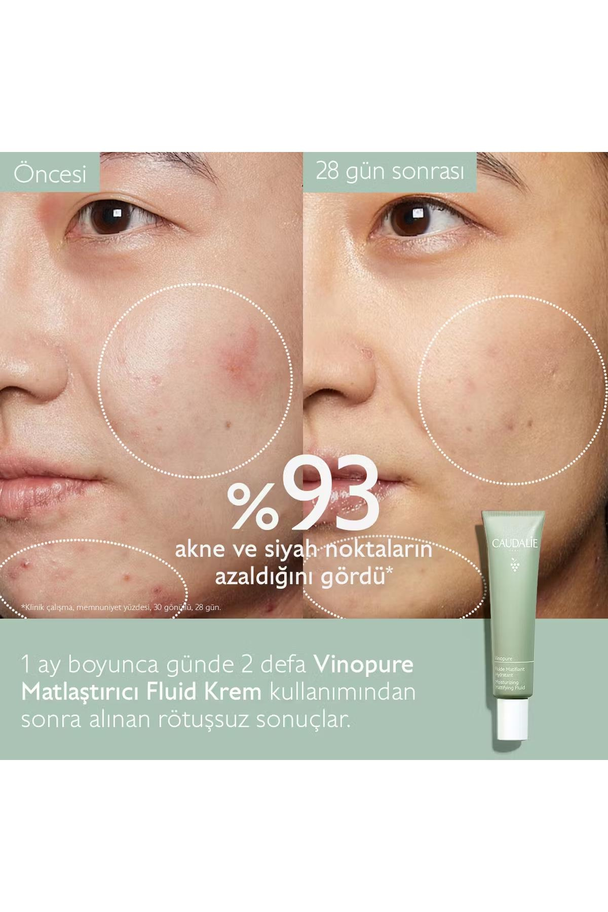 CaudalieCaudalie Vinopure Matlaştırıcı Fluid Krem 40 mlCaudalie Vinopure Matlaştırıcı Krem 40ml | Yağ Kontrolü Sağlar