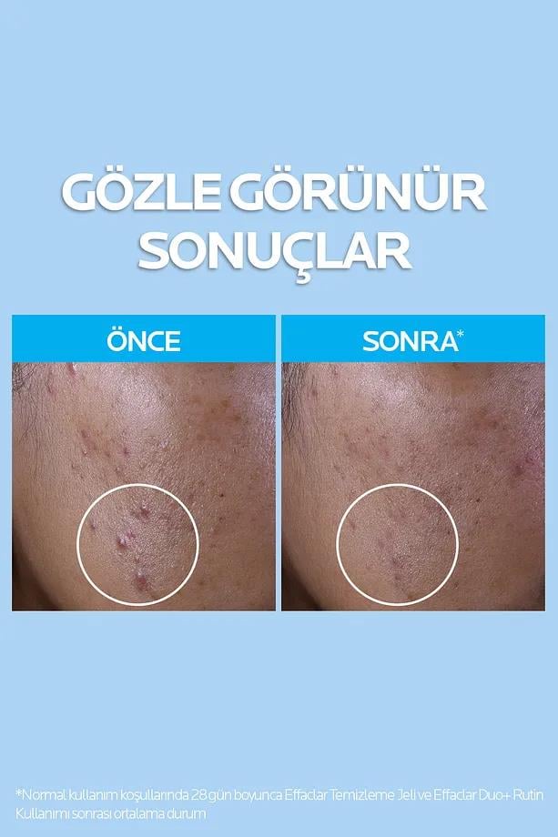 La Roche PosayLa Roche Posay Effaclar Temizleme Jeli 400ml Yağlı Ve Akneye Eğilim Gösteren CiltlerLa Roche Posay Effaclar Temizleme Jeli 400ml Yağlı Ve Akneye Eğilim Gösteren Ciltler | Hızlı Kargo & Orijinal Ürün