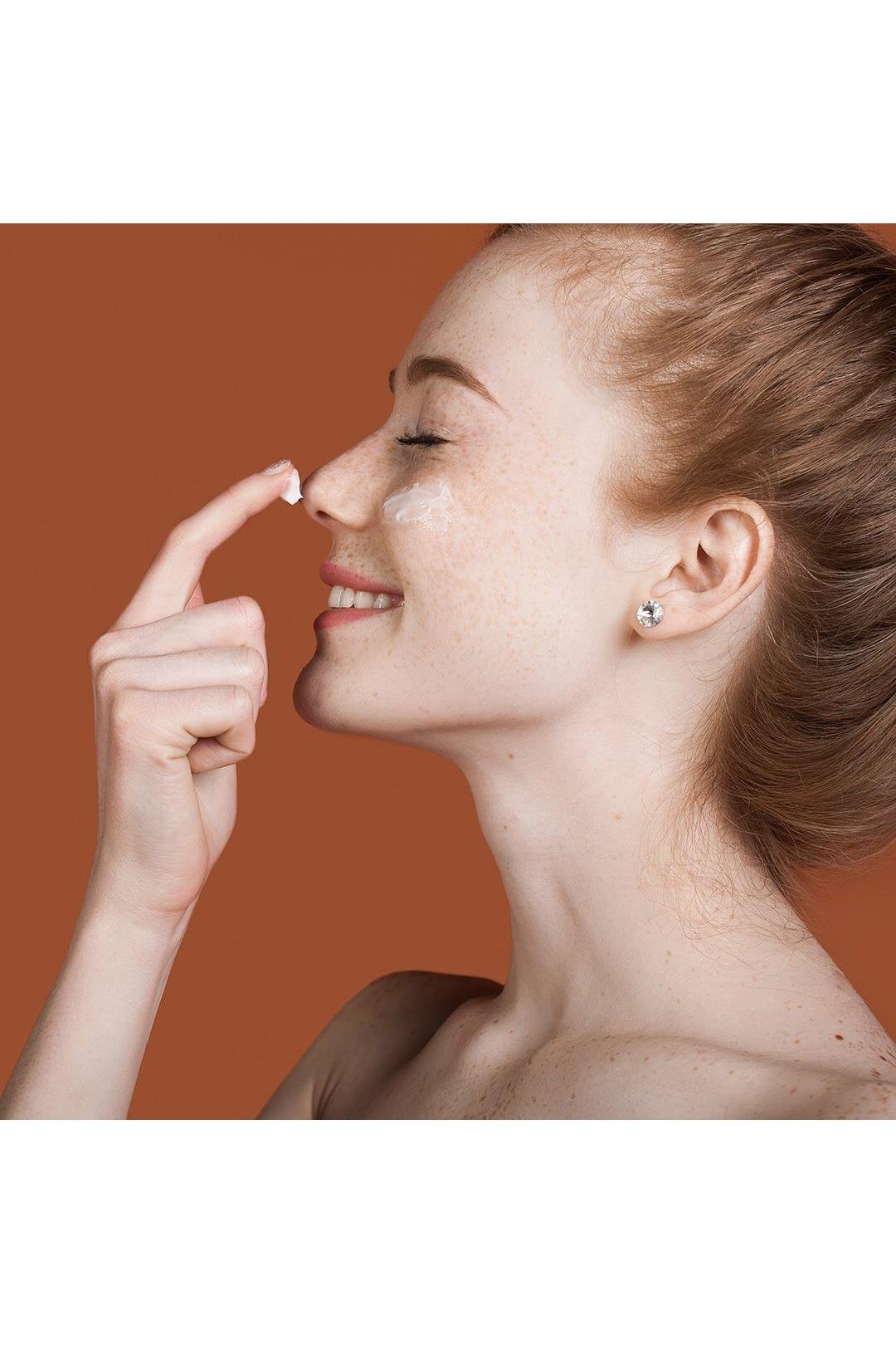 SolanteSolante Acnes Güneş Losyonu SPF 50+ 50 mlSolante Acnes Güneş Koruyucu Losyon SPF50+ | Yağsız Formül