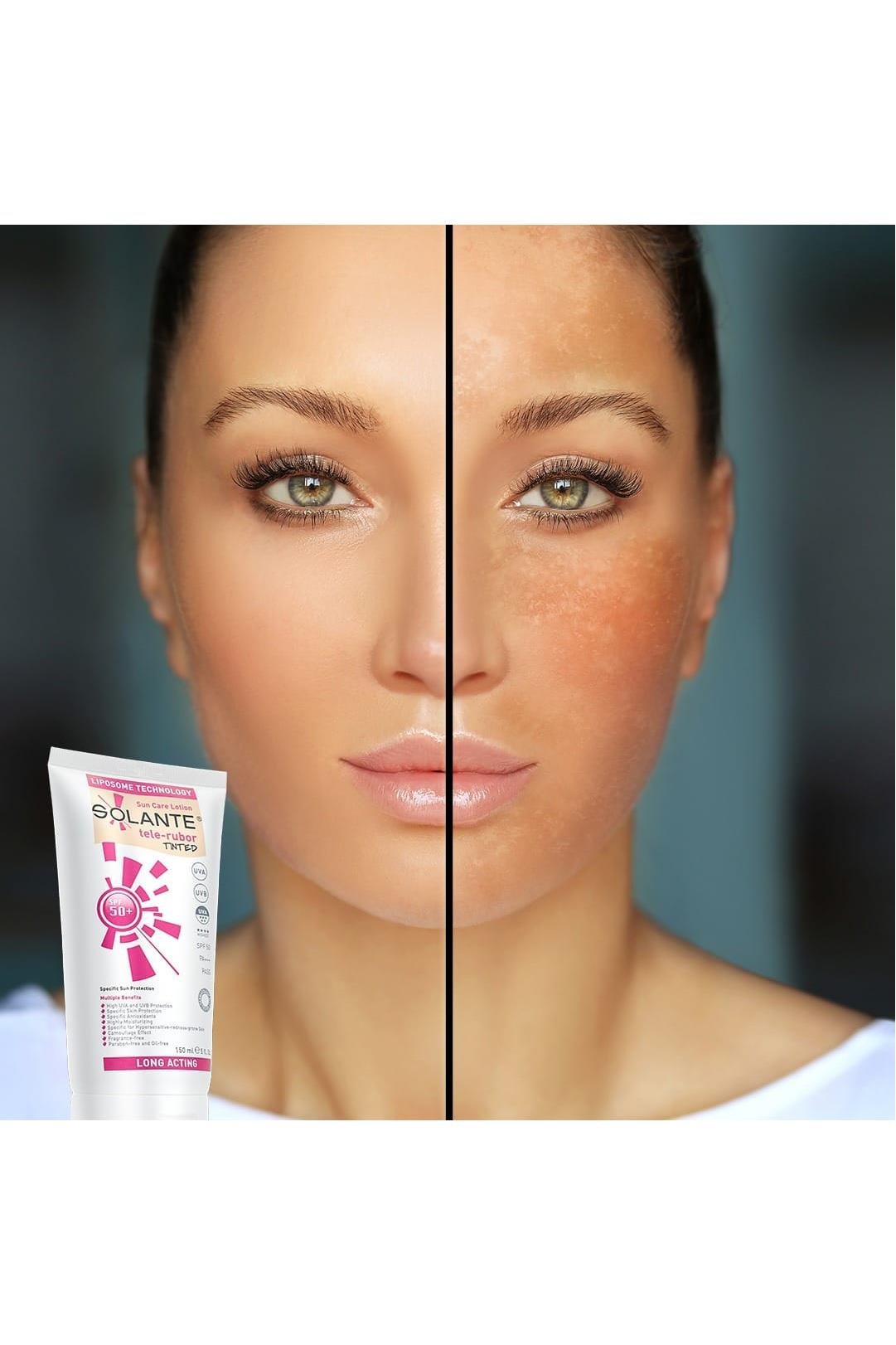 SolanteSolante Tele-Rubor Tinted Renkli Güneş Losyonu SPF 50+ 150 mlSolante Tele-Rubor Tinted SPF50+ 150 ml Fiyatı ve Özellikleri | Mutlufiyatlar