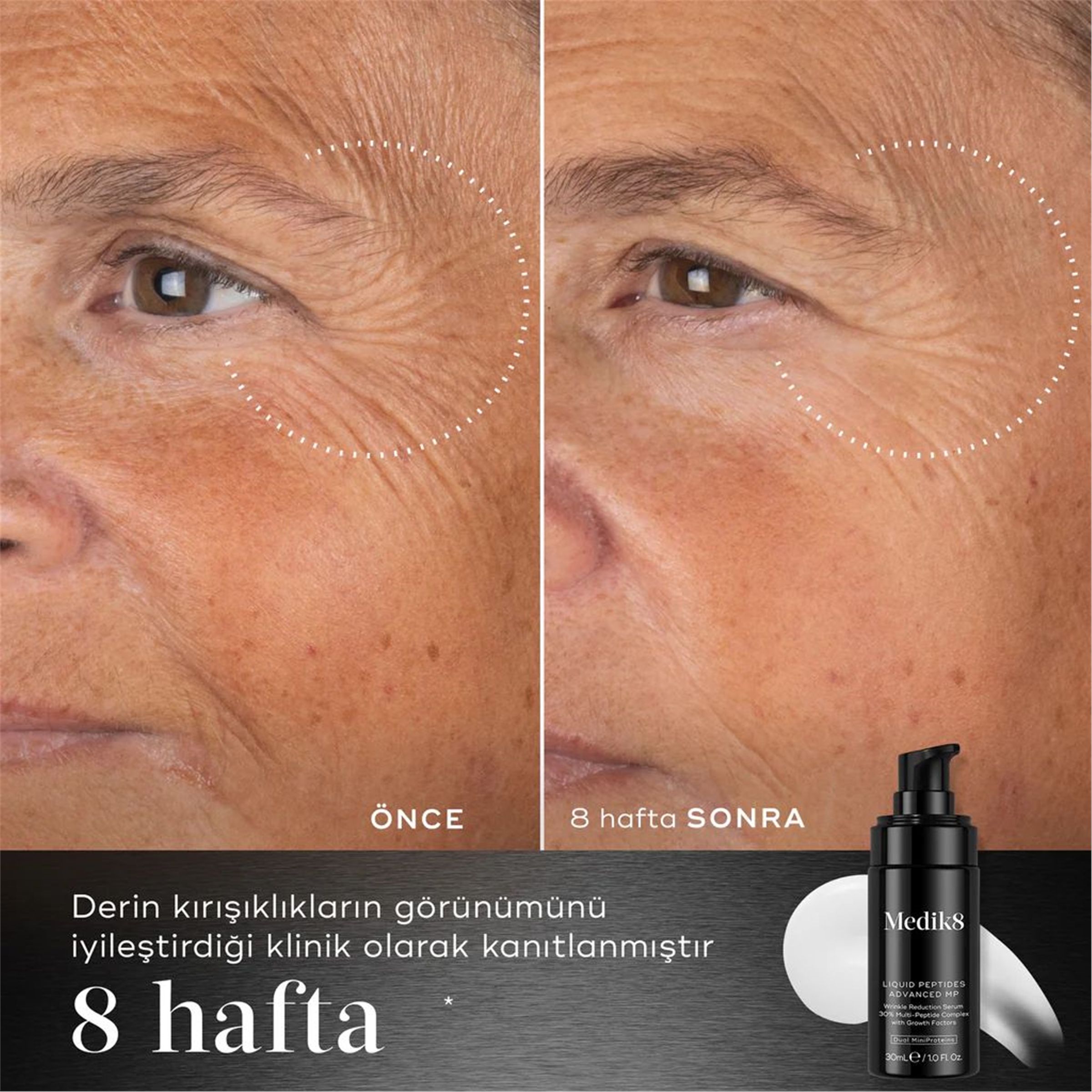 Medik8 Liquıd Peptide Advanced Mp Serum 30Ml P11494