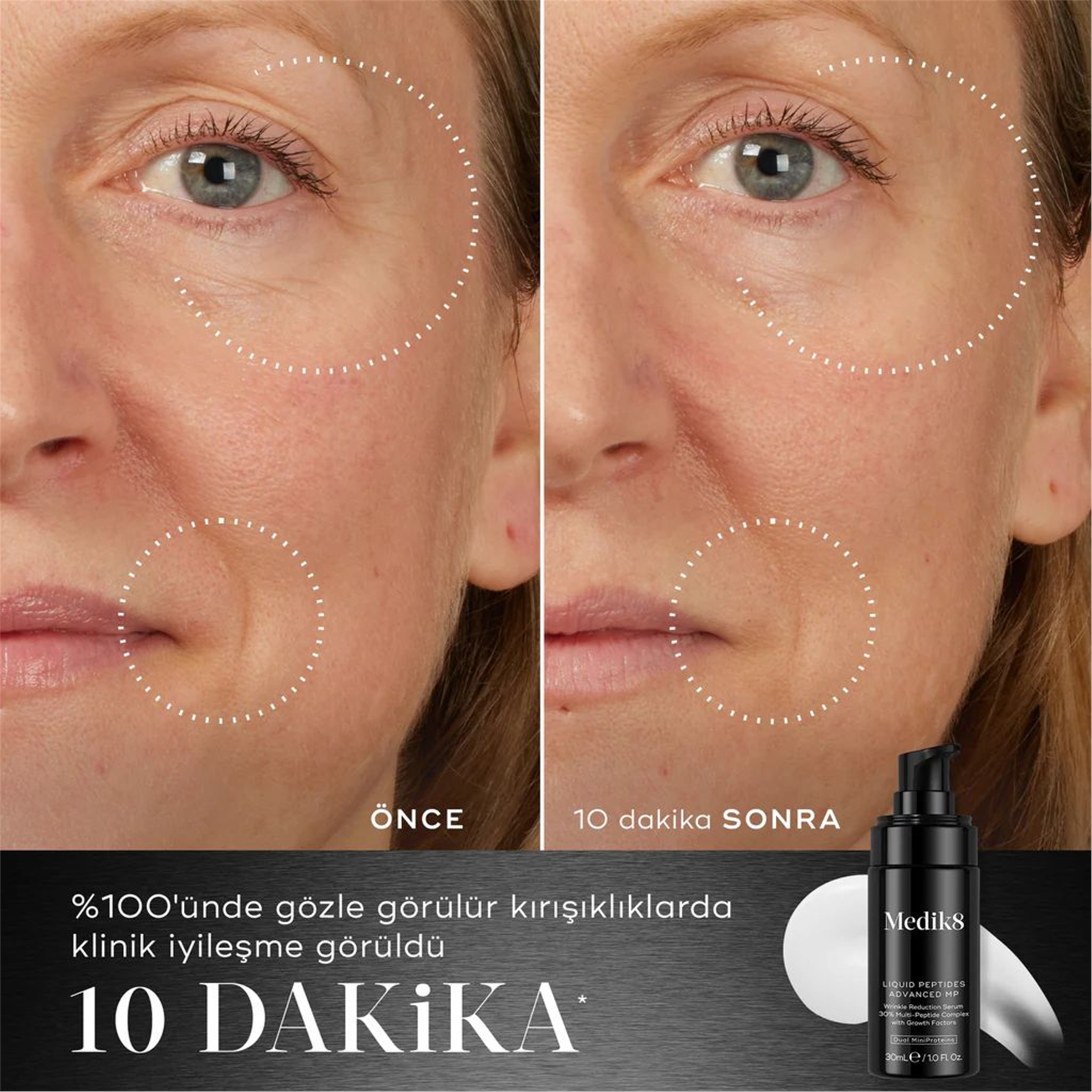 Medik8 Liquıd Peptide Advanced Mp Serum 30Ml P11494
