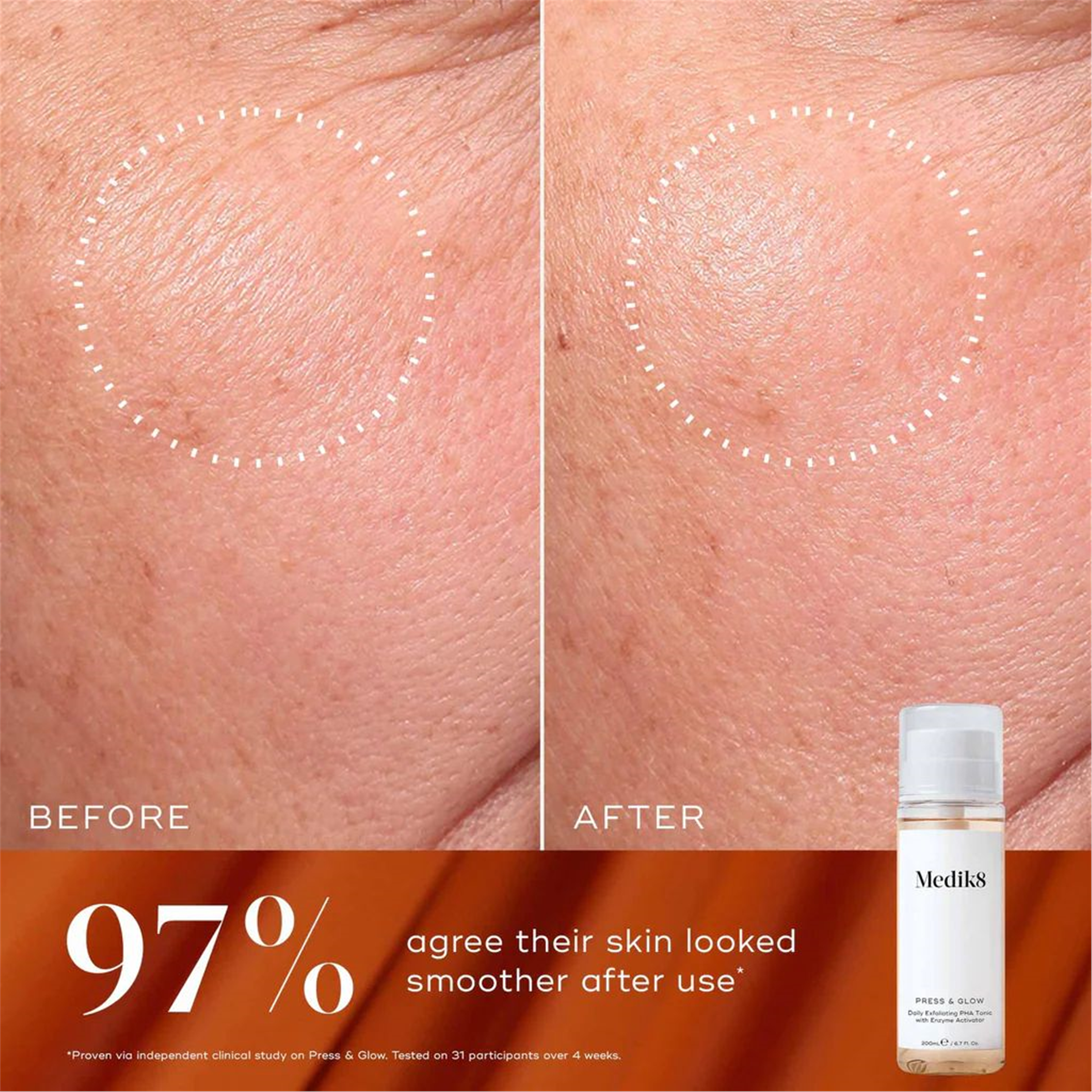 Medik8 Luminous Lift Set-Kırmızı