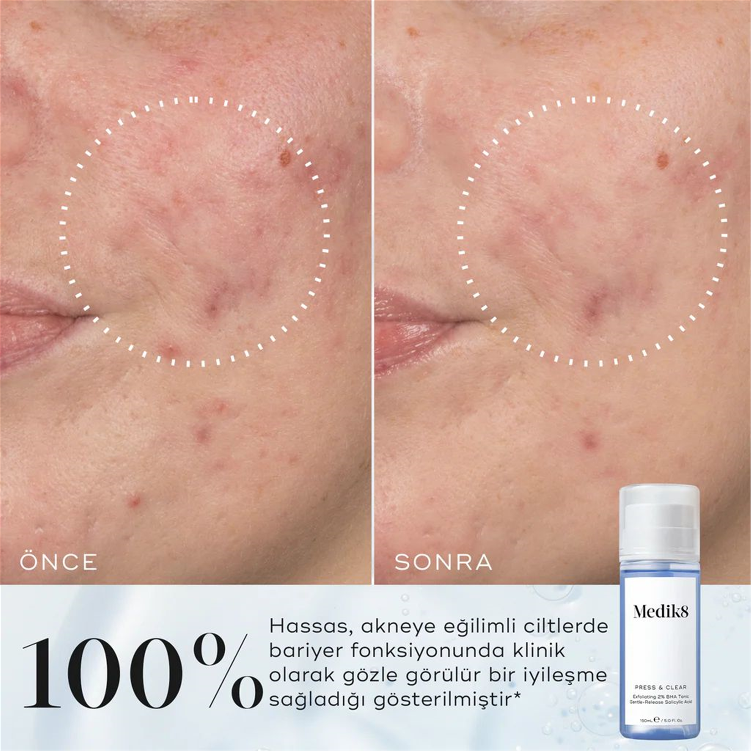 Medik8 Press&Clear 150 Ml P10259
