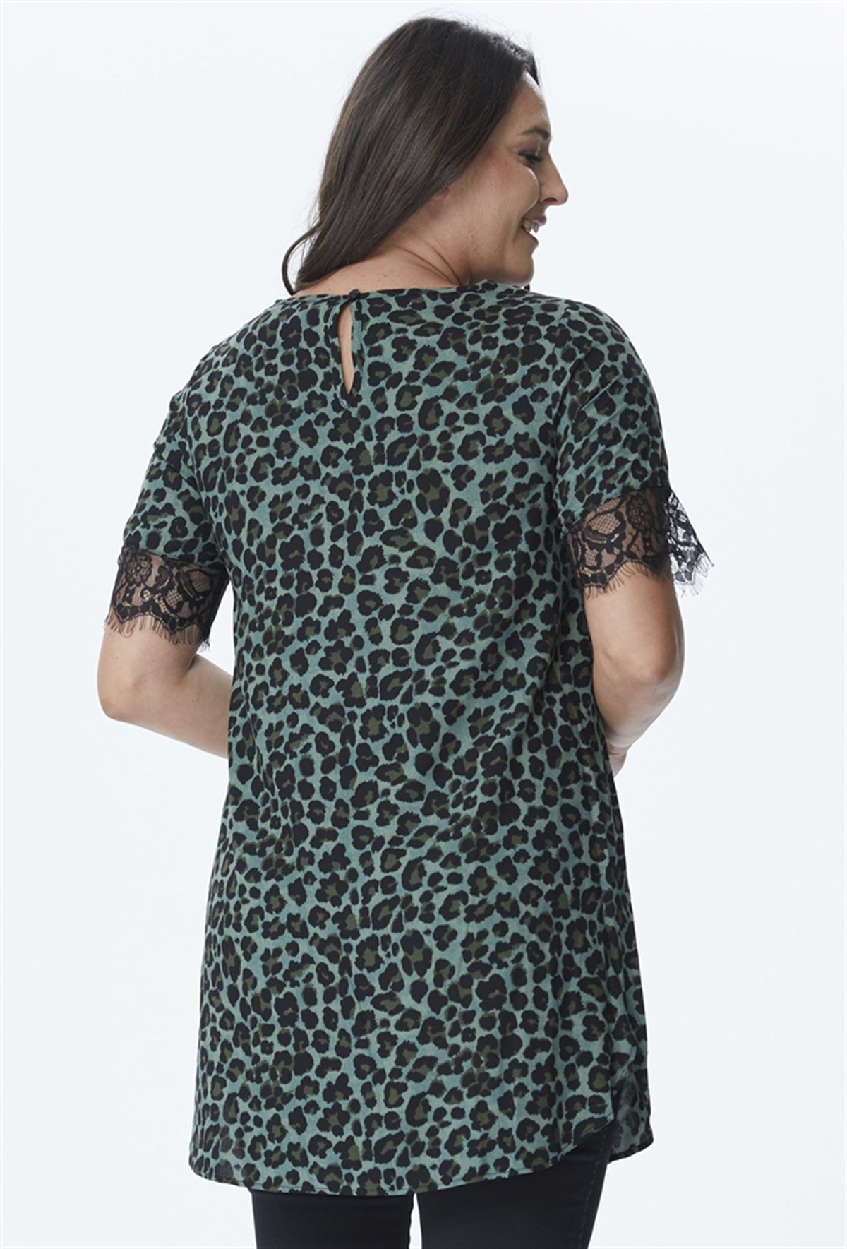 Kolları Dantel V Yaka TunikMYLINE24018