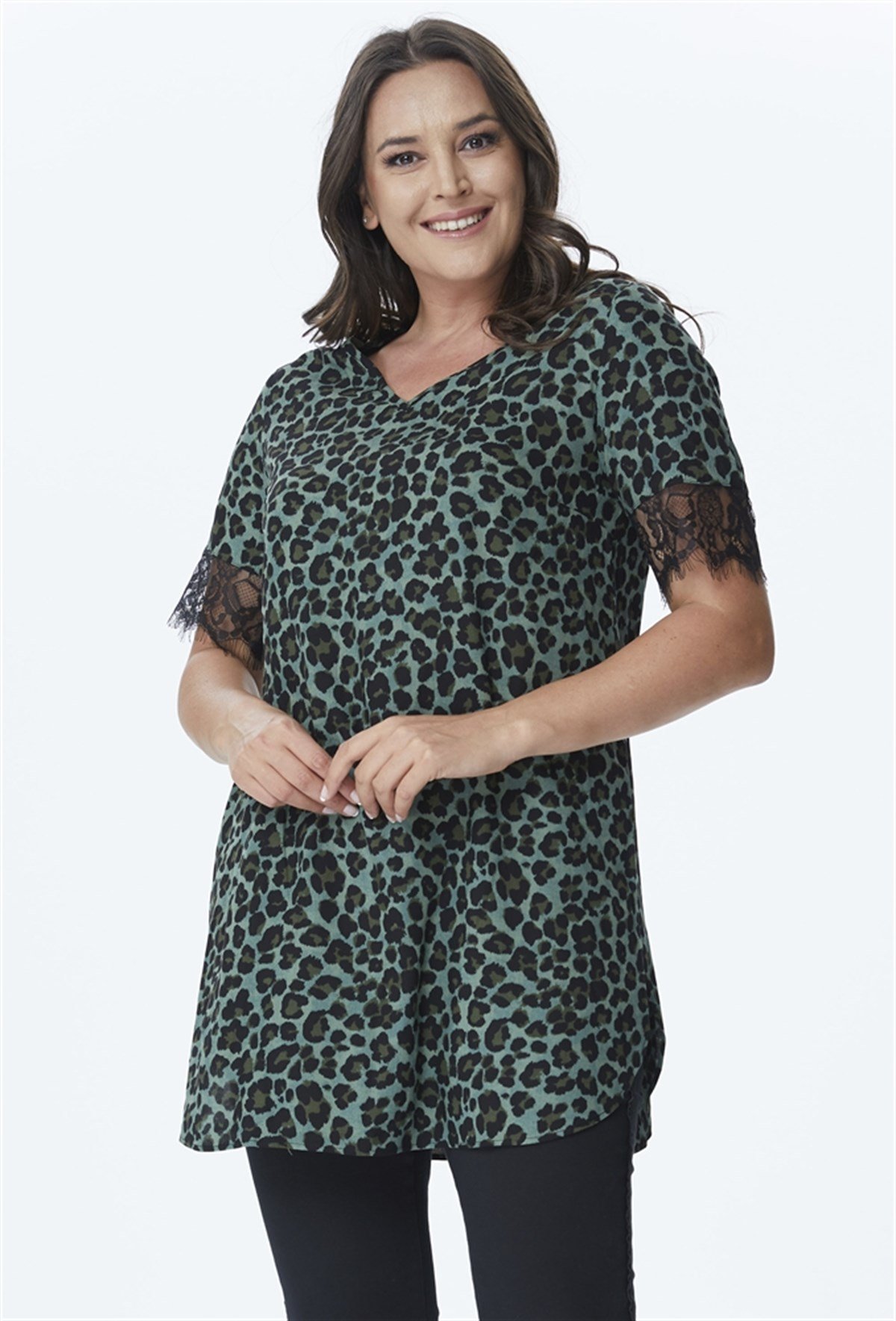 Kolları Dantel V Yaka TunikMYLINE24018