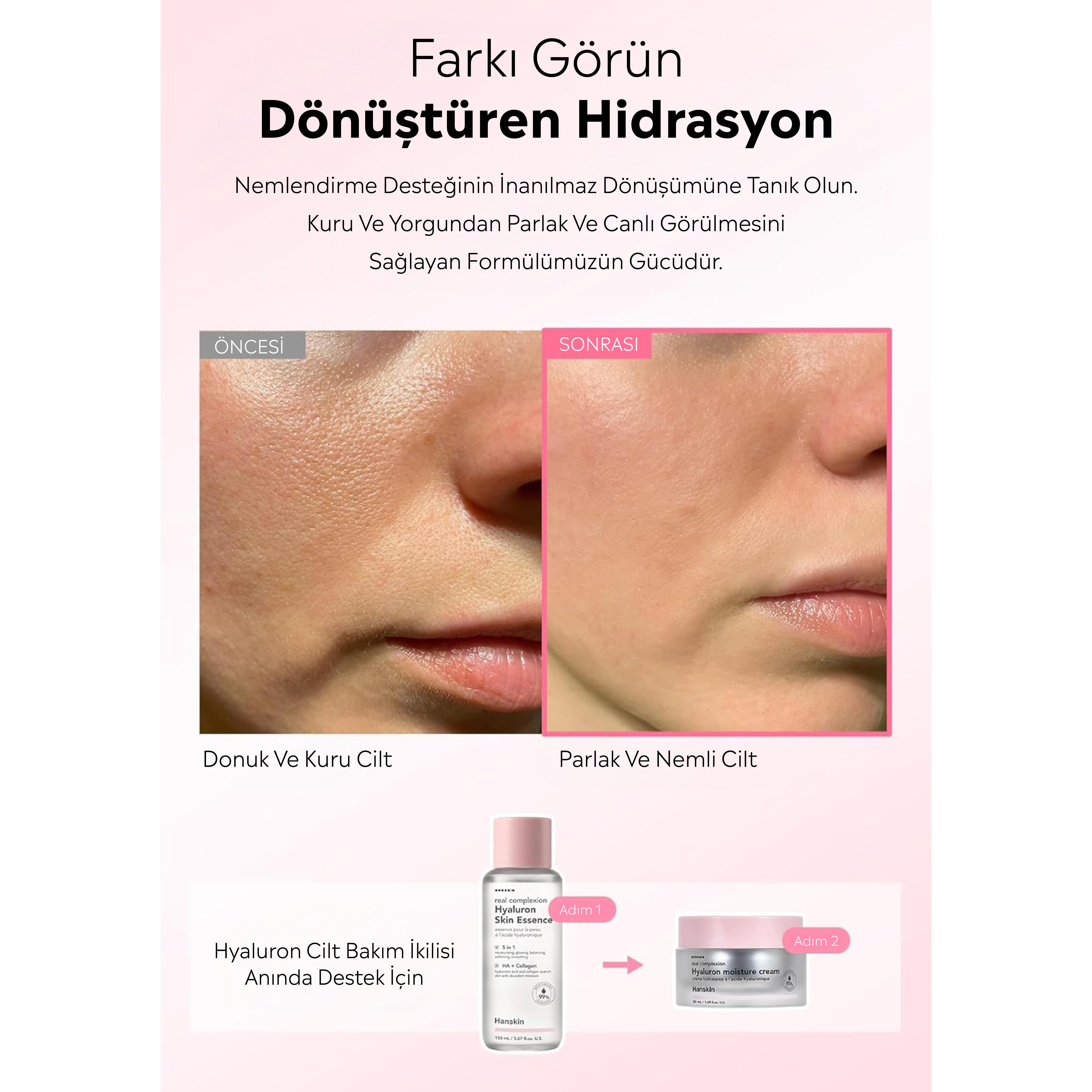 Hanskin Hyaluron Moisture Cream –Hyaluron Nemlendirici Krem (Tüm Cilt Tipleri İçin Uygundur )[50 ml]