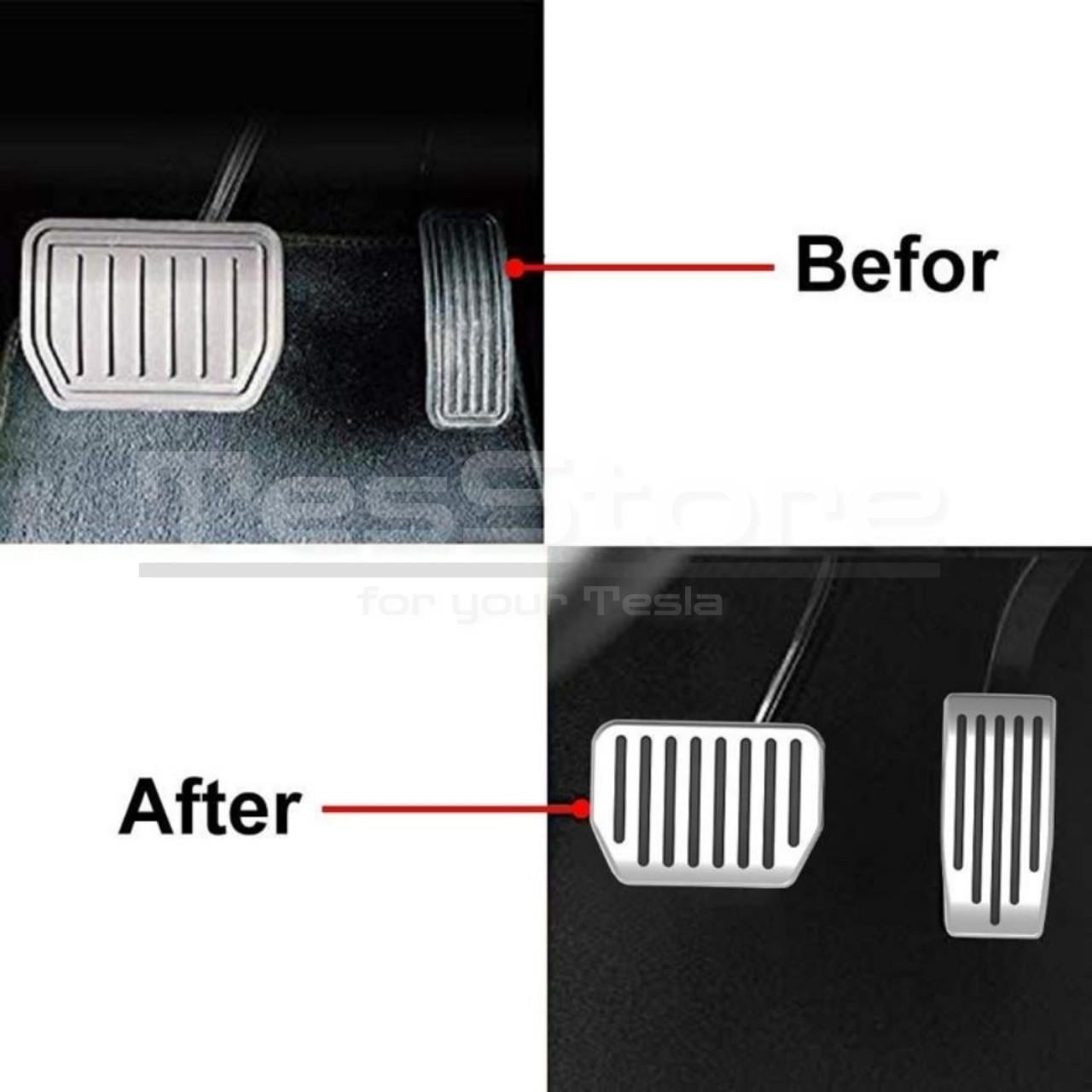 Model Y/3 Performans Pedal Seti