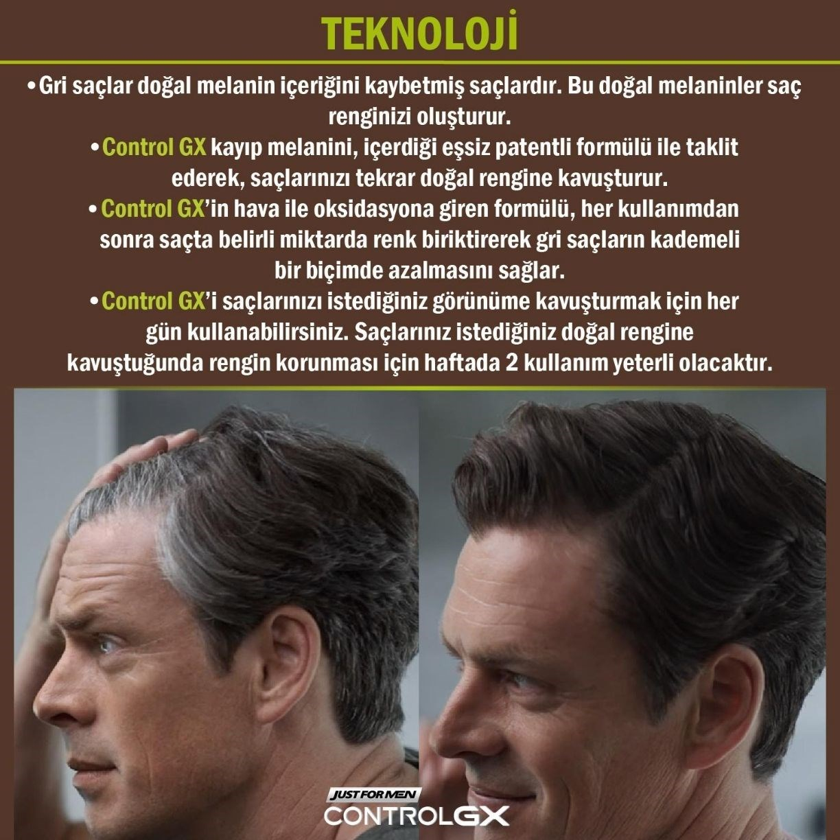Control GX Saç Gri Azaltıcı Şampuan