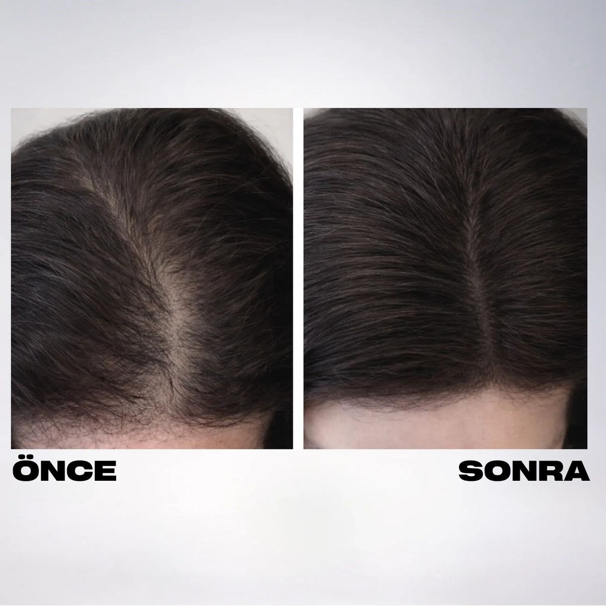 The Cosmetic Republic Dolgunlaştırıcı Saç Fiberi 12,5 gr – Koyu Kahve