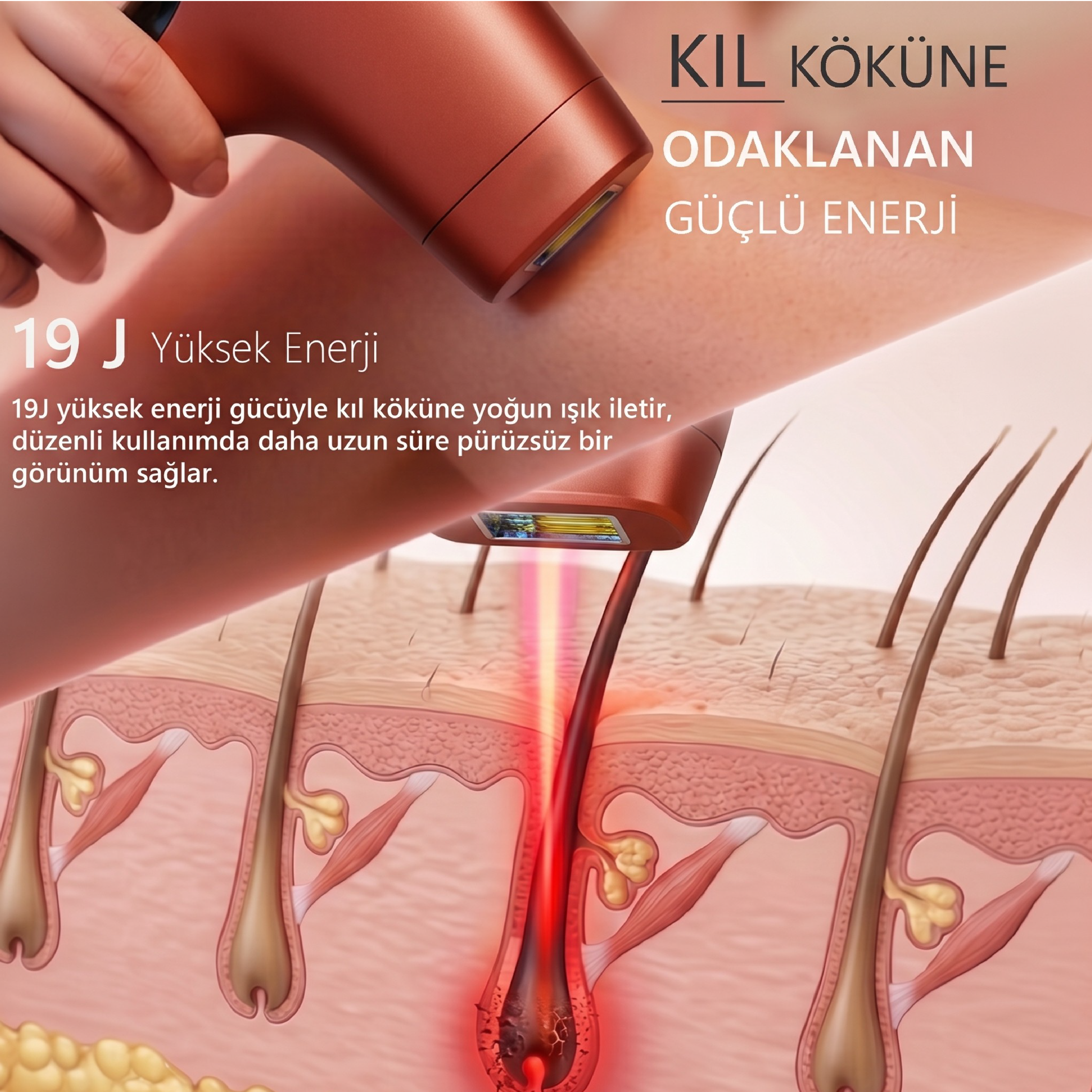 Robx A05 Ipl 3 Milyon Atım Akıllı Cilt Tanıma Ultra Seri Atım Ipl Cihazı Kırmızı