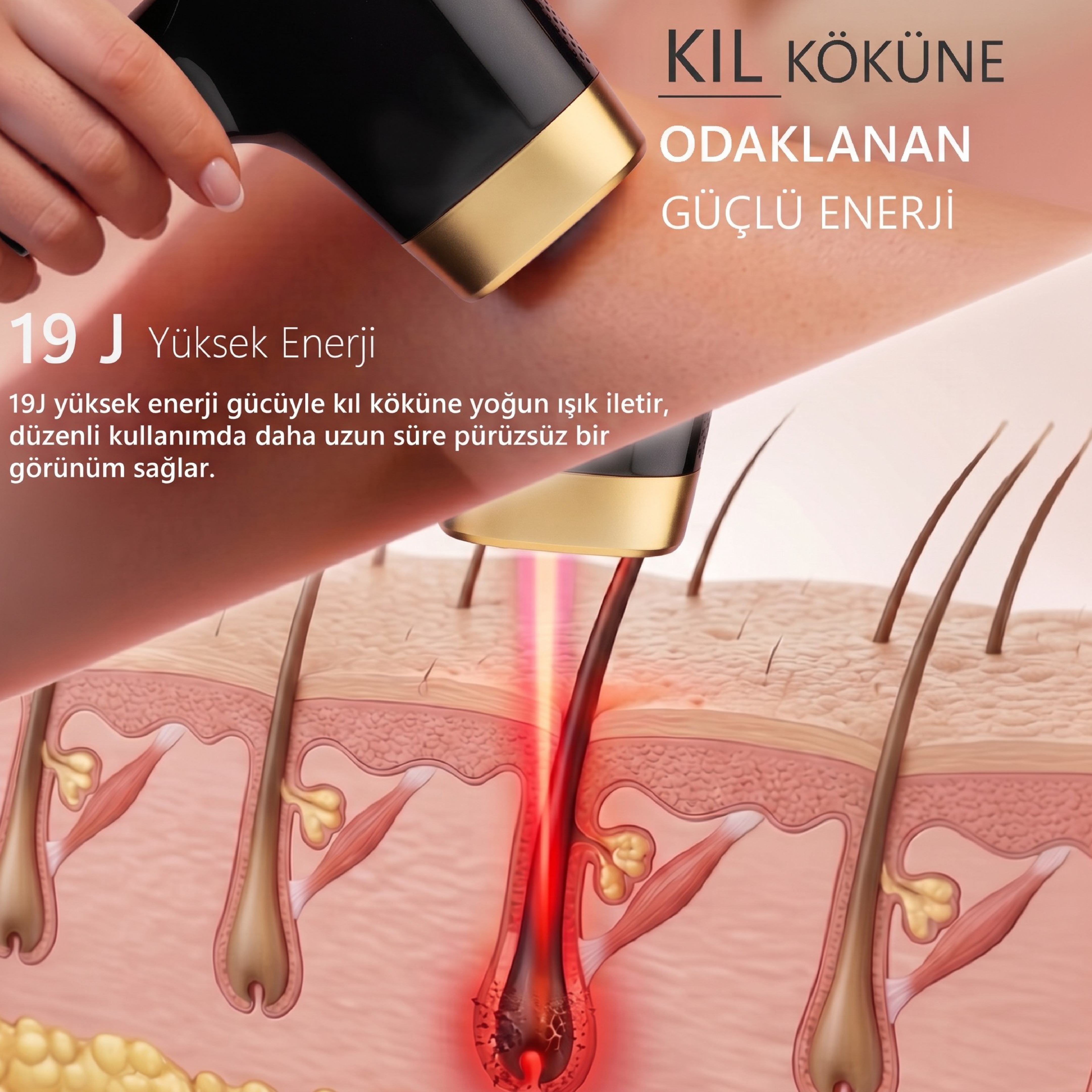 Robx A05 Ipl 3 Milyon Atım Akıllı Cilt Tanıma Ultra Seri Atım Ipl Cihazı Siyah