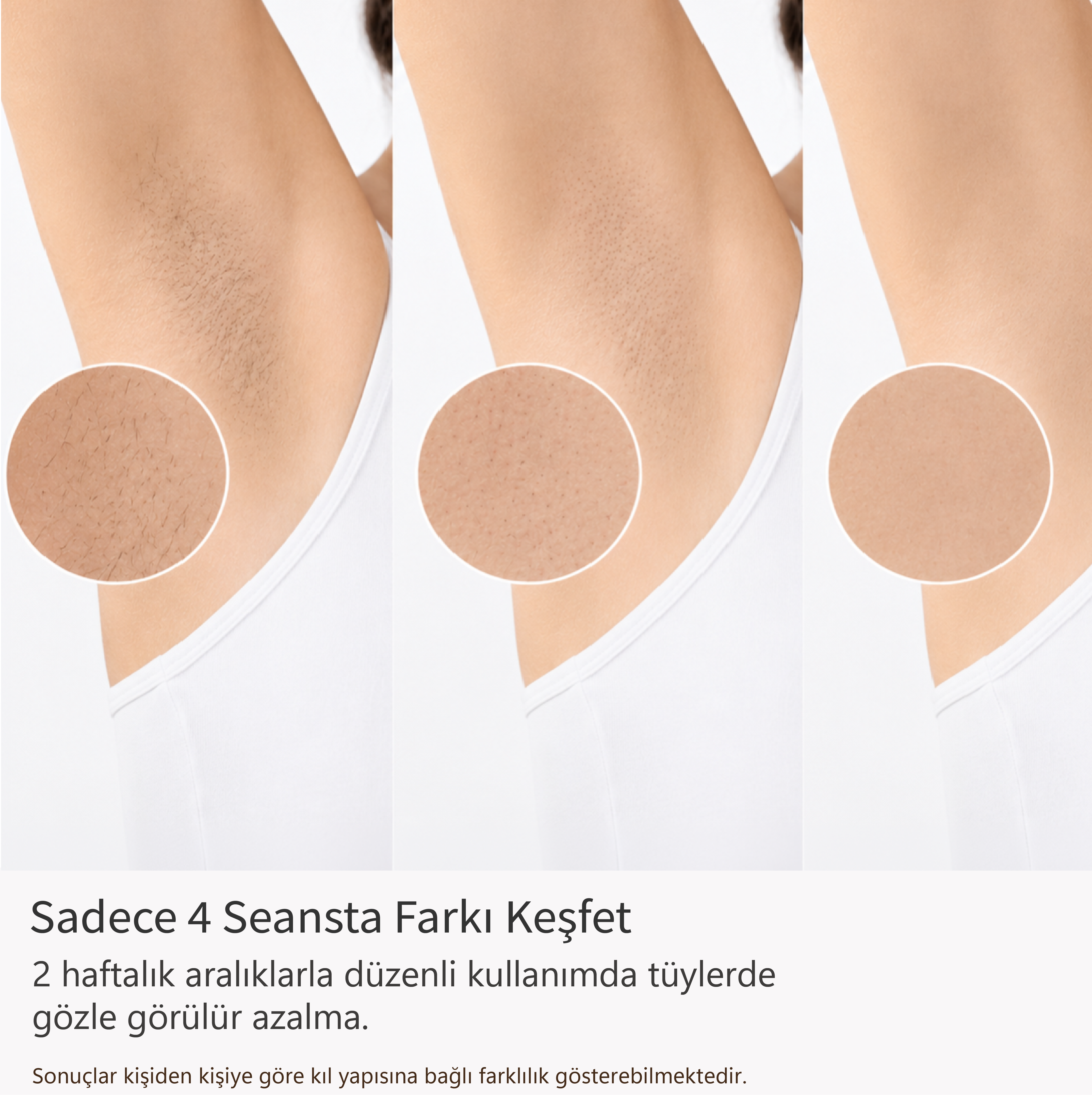 Robx A05 Ipl 3 Milyon Atım Akıllı Cilt Tanıma Ultra Seri Atım Ipl Cihazı Pembe