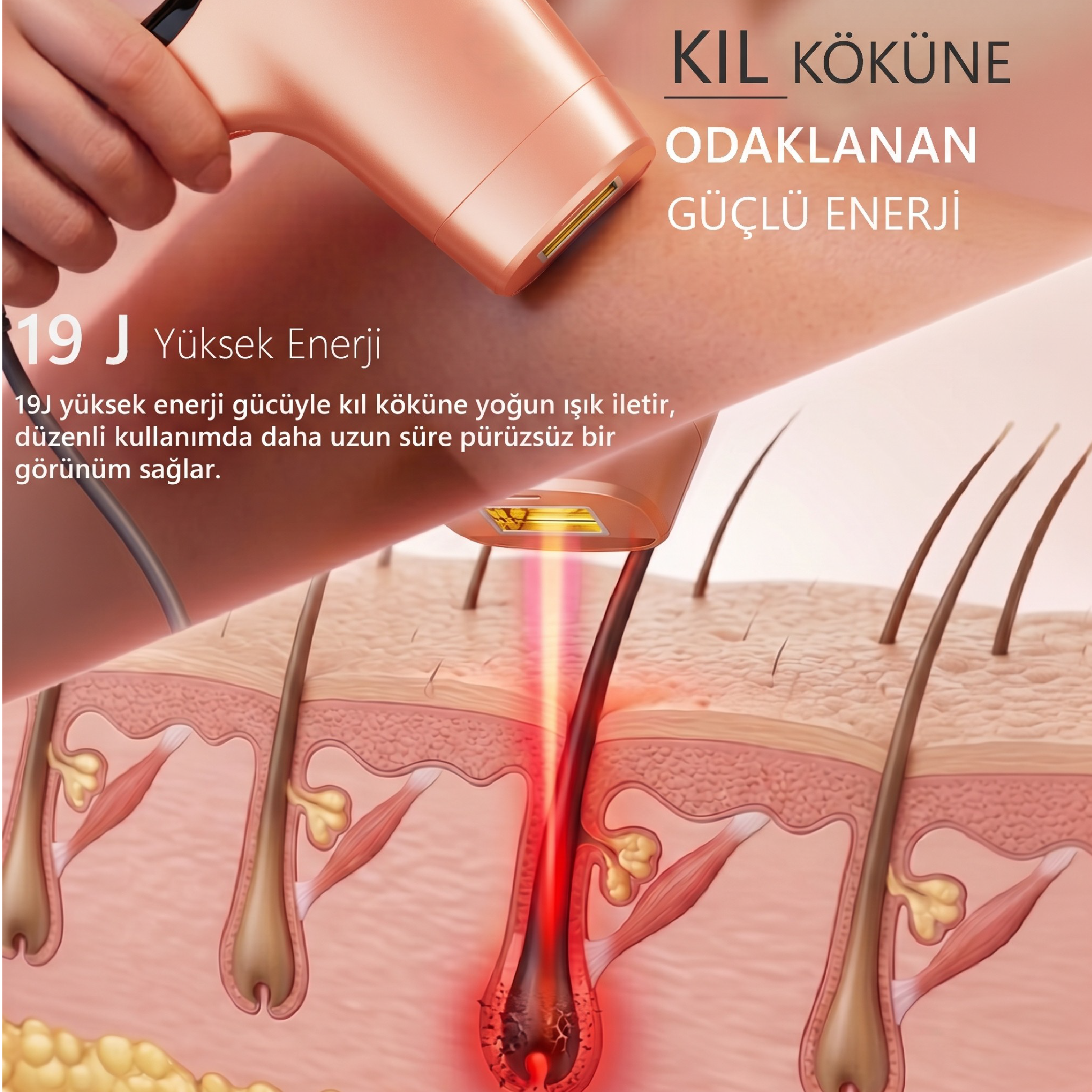 Robx A05 Ipl 3 Milyon Atım Akıllı Cilt Tanıma Ultra Seri Atım Ipl Cihazı Turuncu 