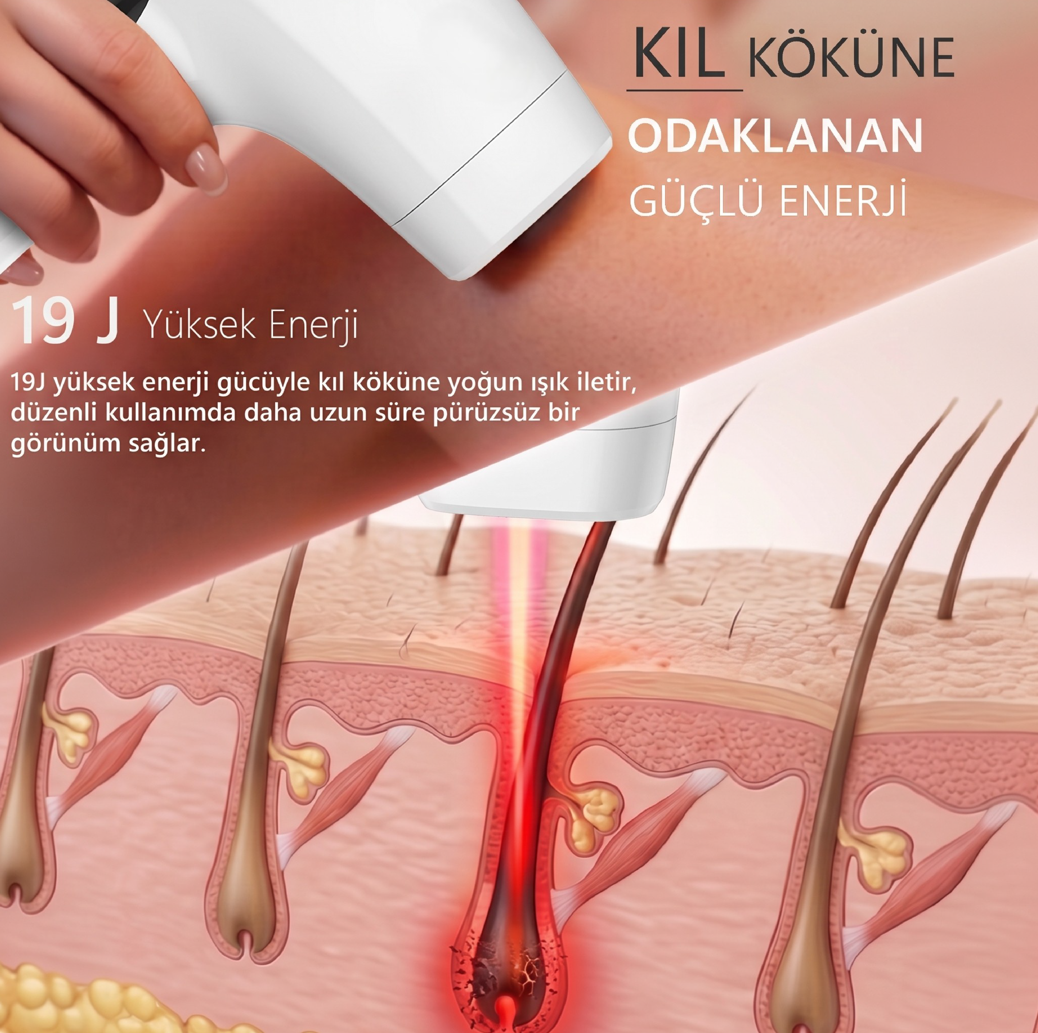 Robx A05 Ipl 3 Milyon Atım Akıllı Cilt Tanıma Ultra Seri Atım Ipl Cihazı Beyaz