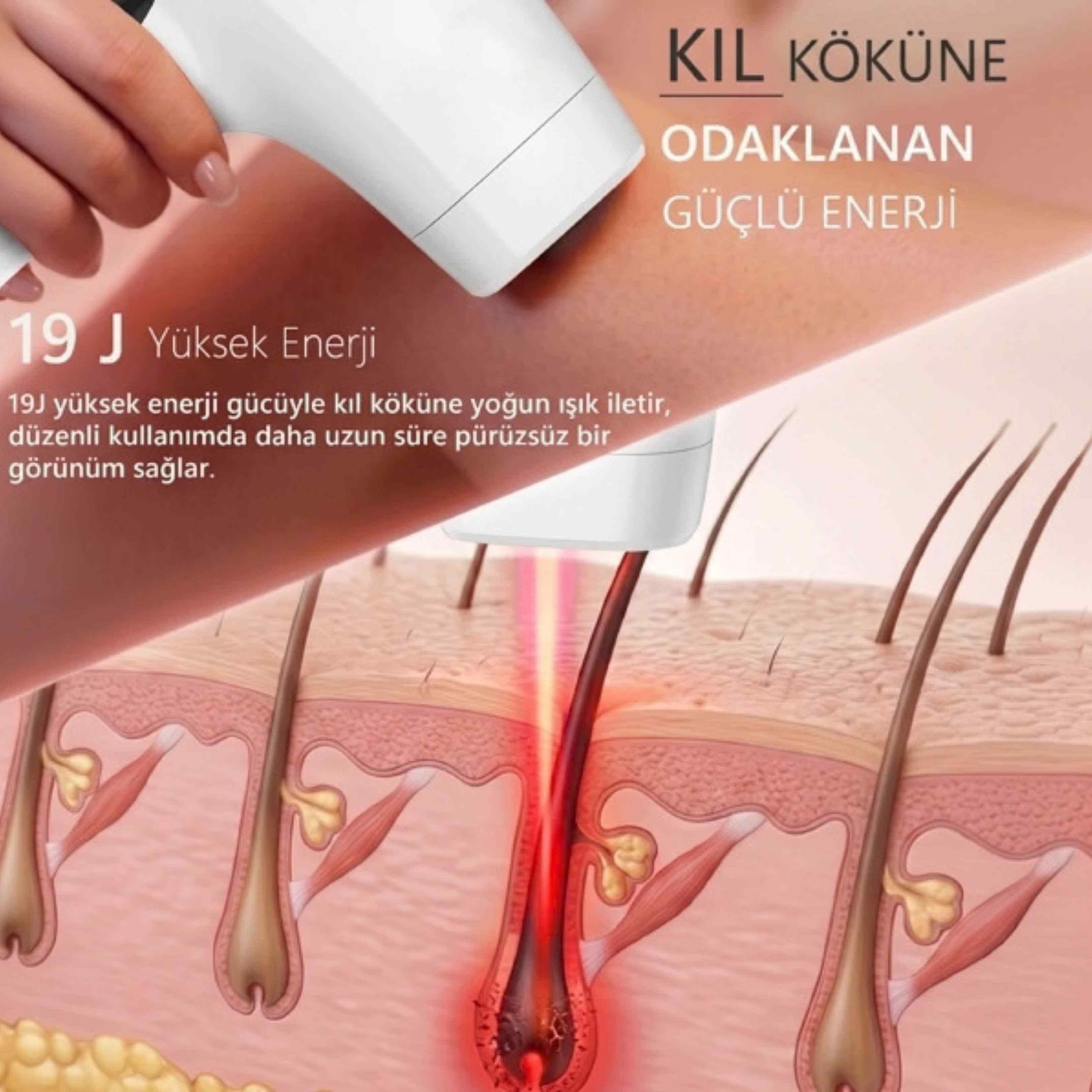 Robx A05 Ipl 3 Milyon Atım Akıllı Cilt Tanıma Ultra Seri Atım Ipl Cihazı Beyaz