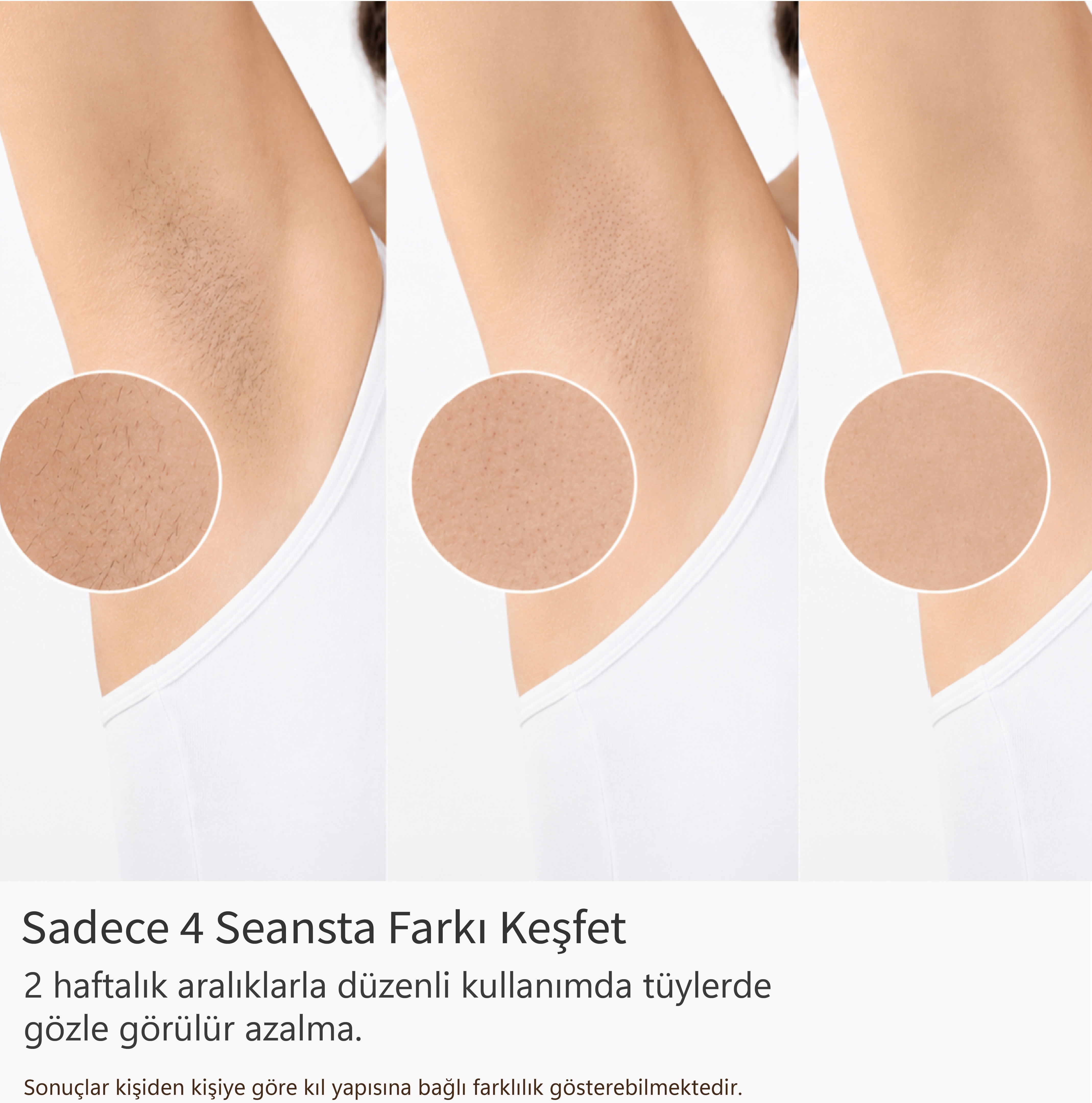 Robx A05 Ipl 3 Milyon Atım Akıllı Cilt Tanıma Ultra Seri Atım Ipl Cihazı Kırmızı