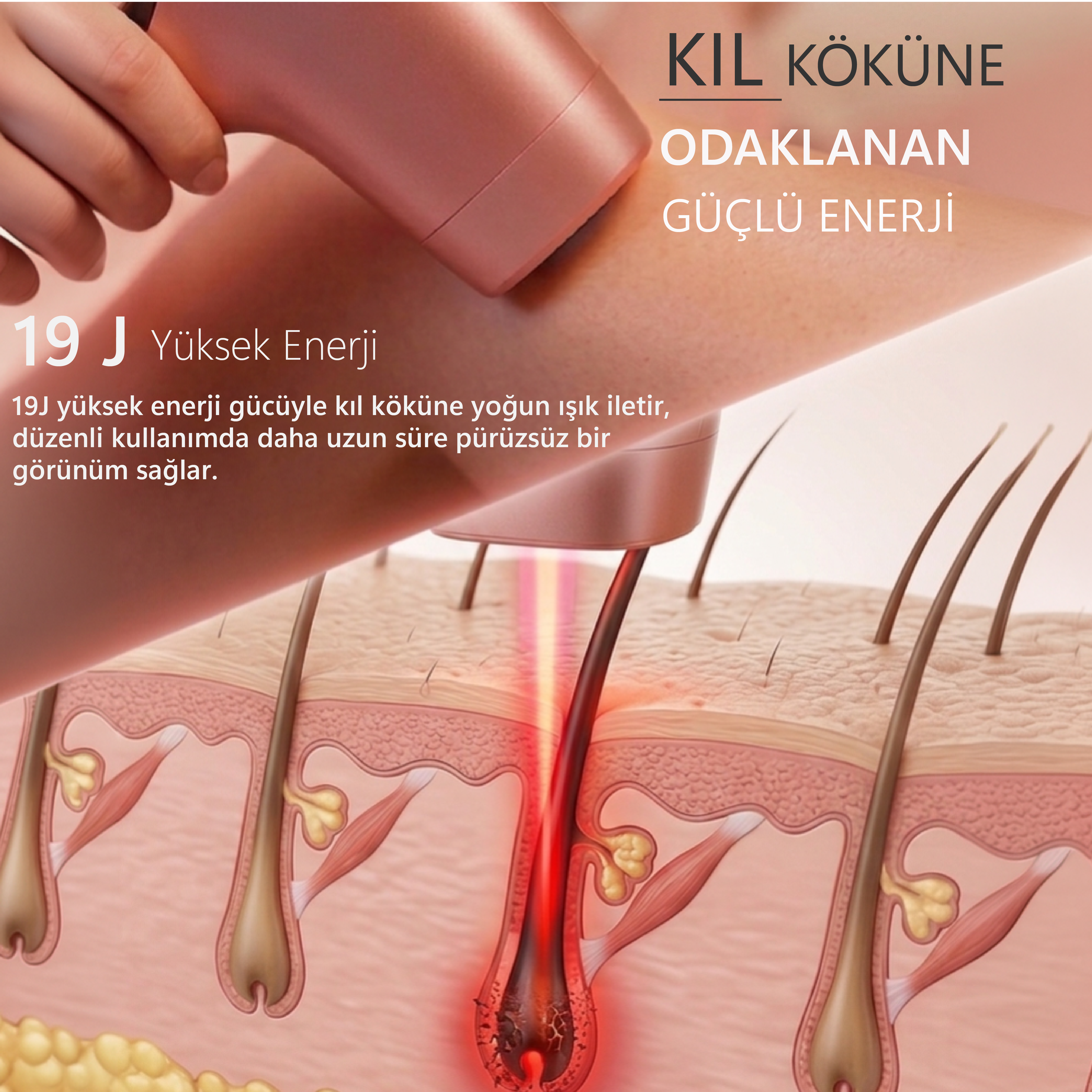 Robx A05 Ipl 3 Milyon Atım Akıllı Cilt Tanıma Ultra Seri Atım Ipl Cihazı Pembe