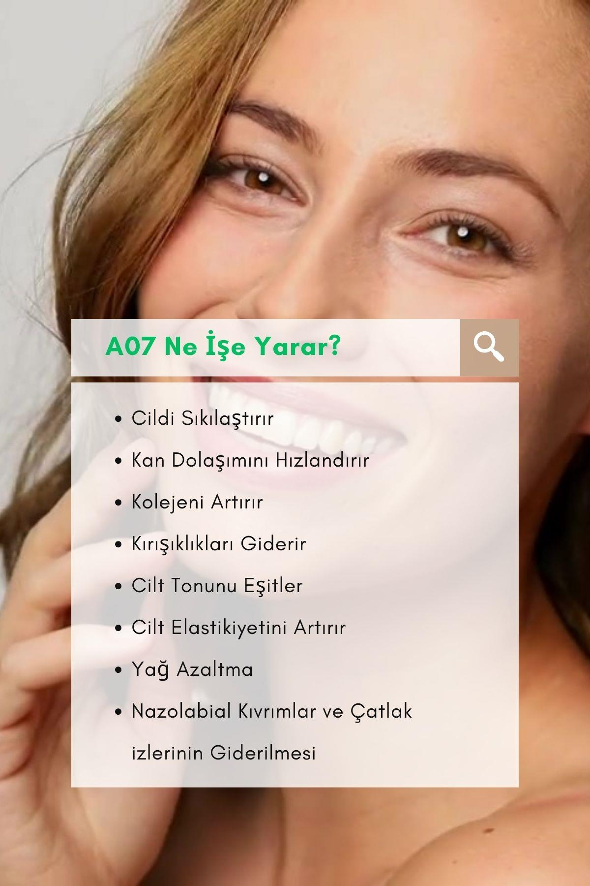Robx A07 Yeni Nesil Rf-EMS Cilt Sıkılaştırıcı Sarkma Sivilce Ve Kırışıklık Giderici Yüz ve Vücut Aleti