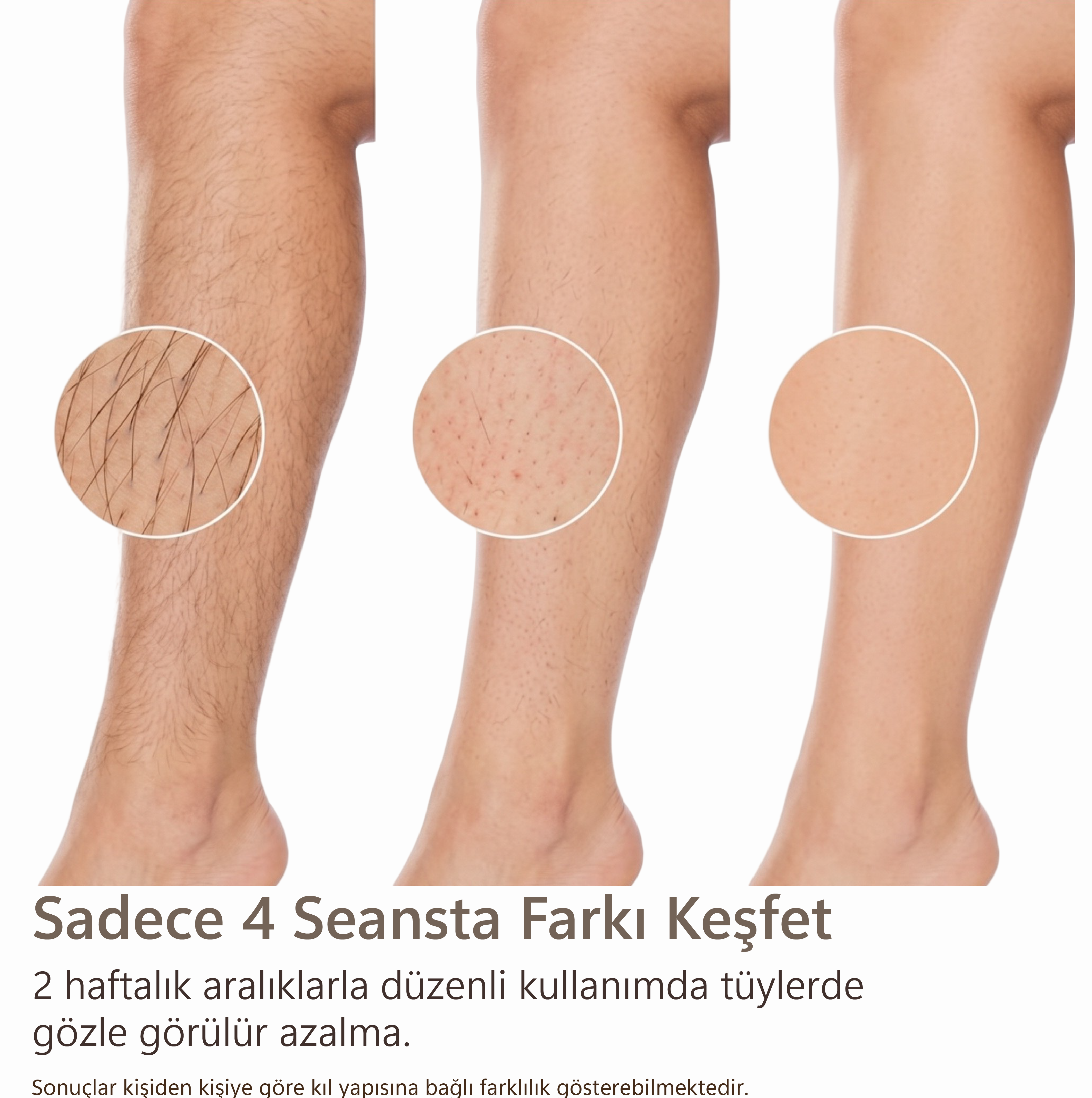 Robx A2024 Yeni Seri IPL 3 Milyon Atım Bay-Bayan IPL Cihazı Beyaz 