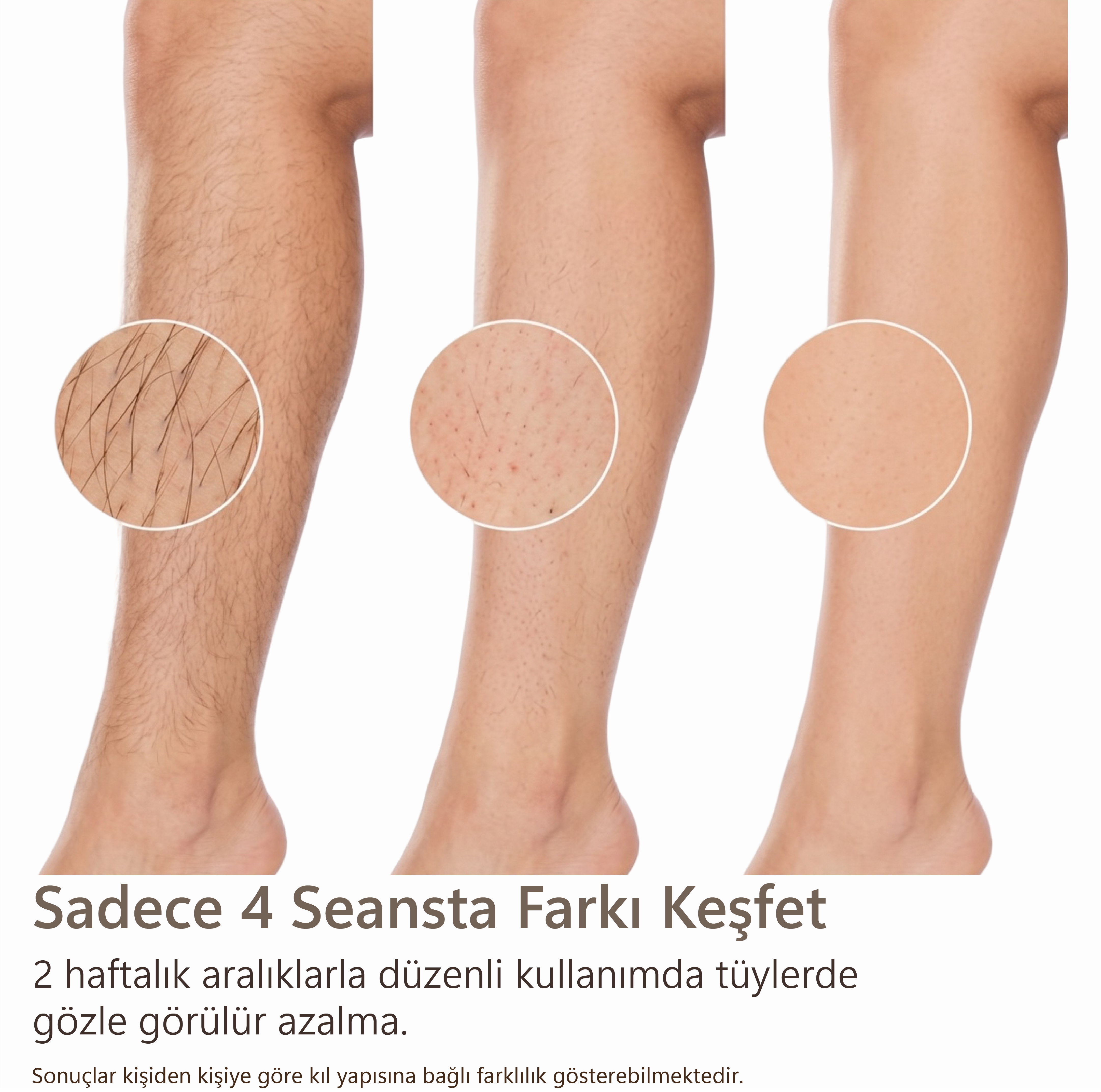 Robx A2024 Yeni Seri IPL 3 Milyon Atım Bay-Bayan IPL Cihazı Pembe