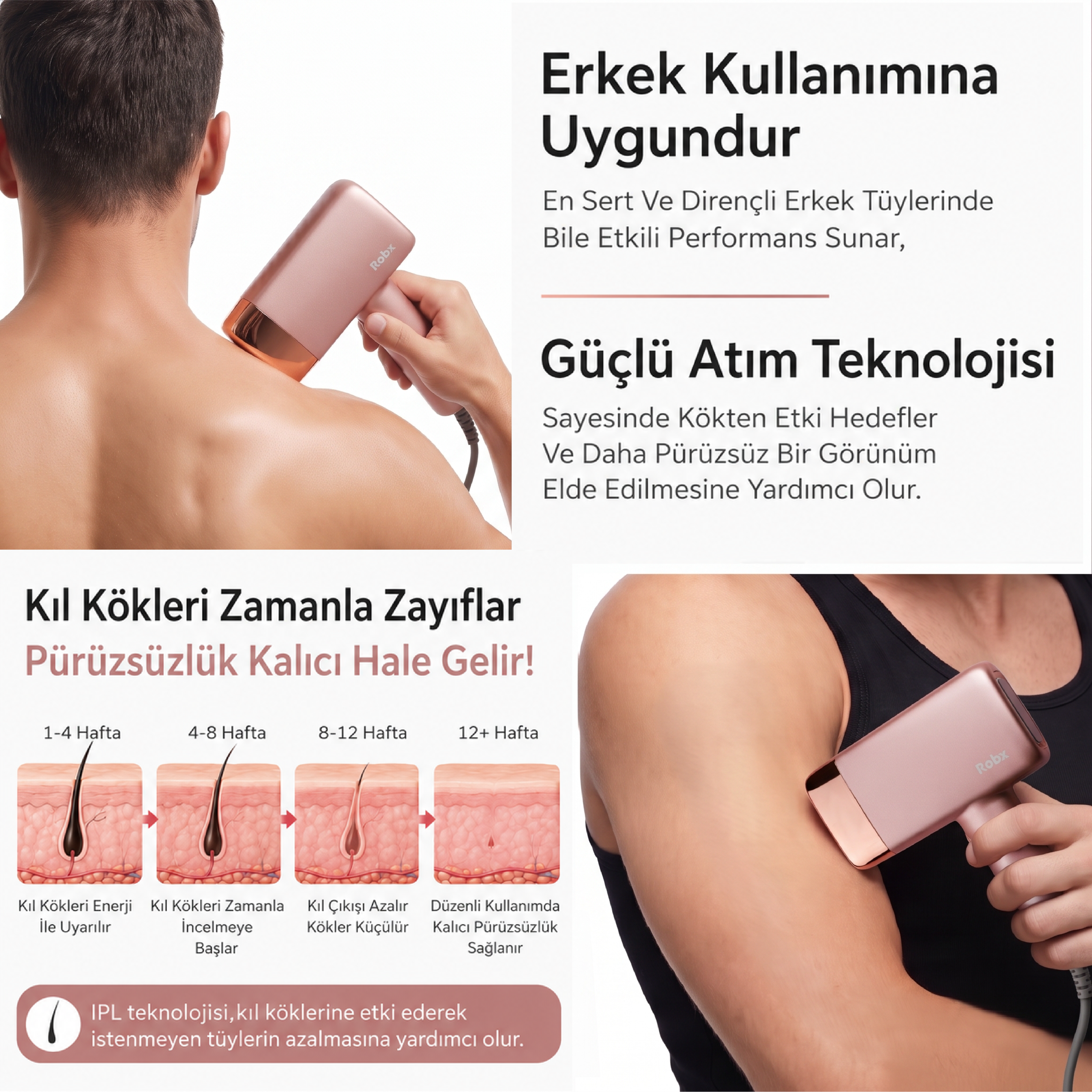 Robx A2024 Yeni Seri IPL 3 Milyon Atım Bay-Bayan IPL Cihazı Pembe